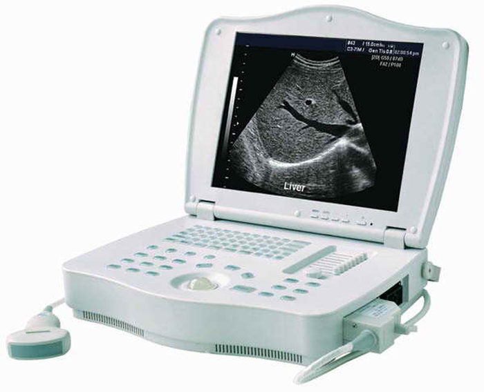 Medical-Device-Types-Best-Portable-Laptop-Ultrasound-Scanner-Machine-Price