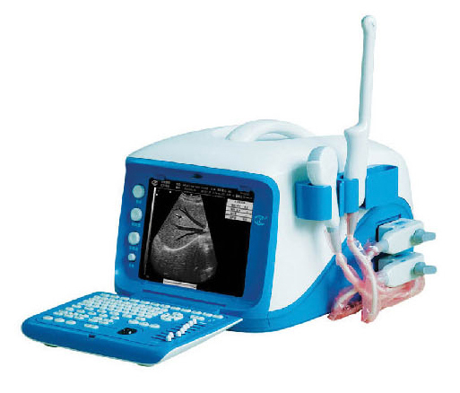 Digital-Ultrasound-Scanner-Ultrasound-Machine