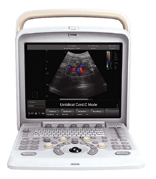 PT405-4D-Portable-Color-Doppler