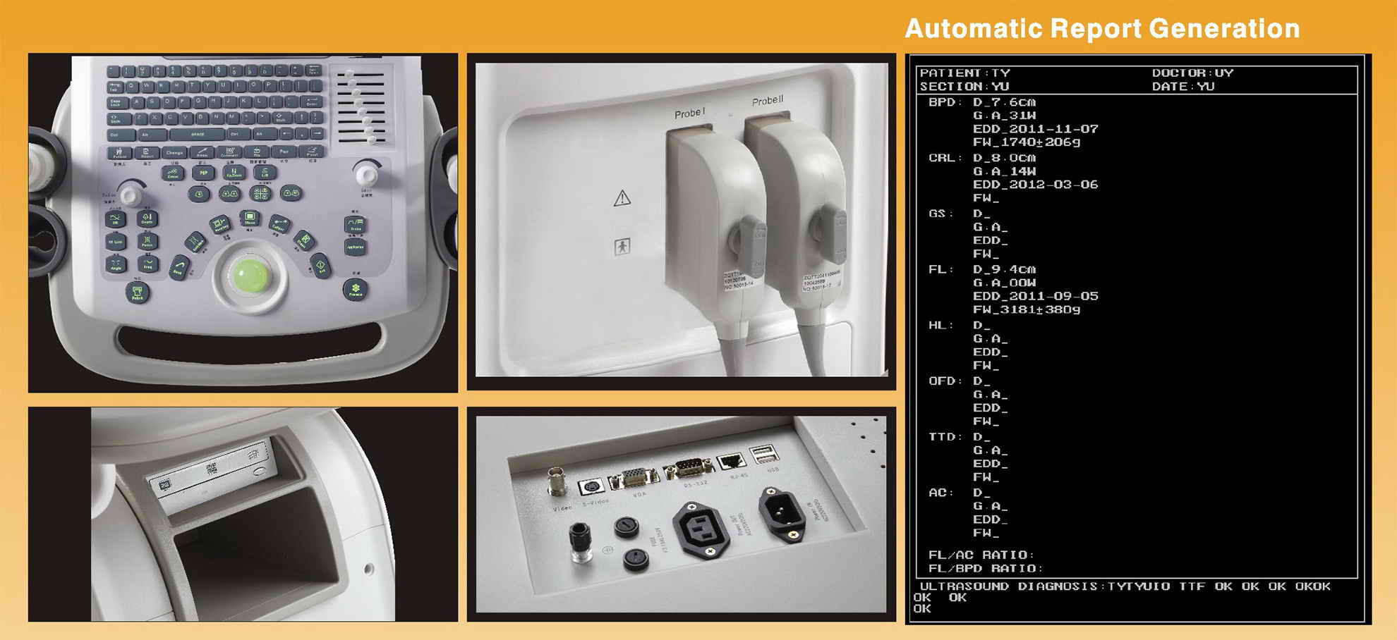 Digital-Ultrasound-Diagnostic-System-1