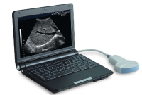 PT3000d1-Laptop-Full-Digital-Ultrasound
