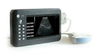 Handheld-Digital-Diagnostic-Ultrasound-System