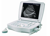 Full-Digital-Portable-Ultrasound-Scanner