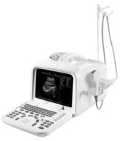 Digital-Ultrasound-Diagnostic-System
