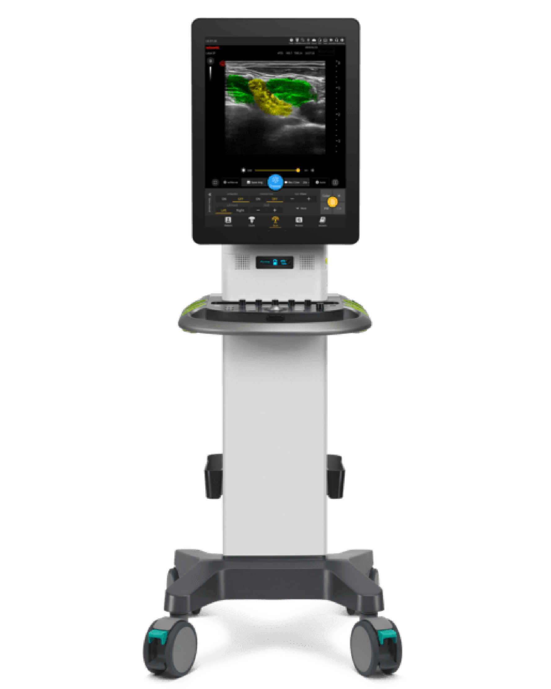 Anesthesia And Pain Management Ultrasound Anorge Industrial Tech Co Ltd