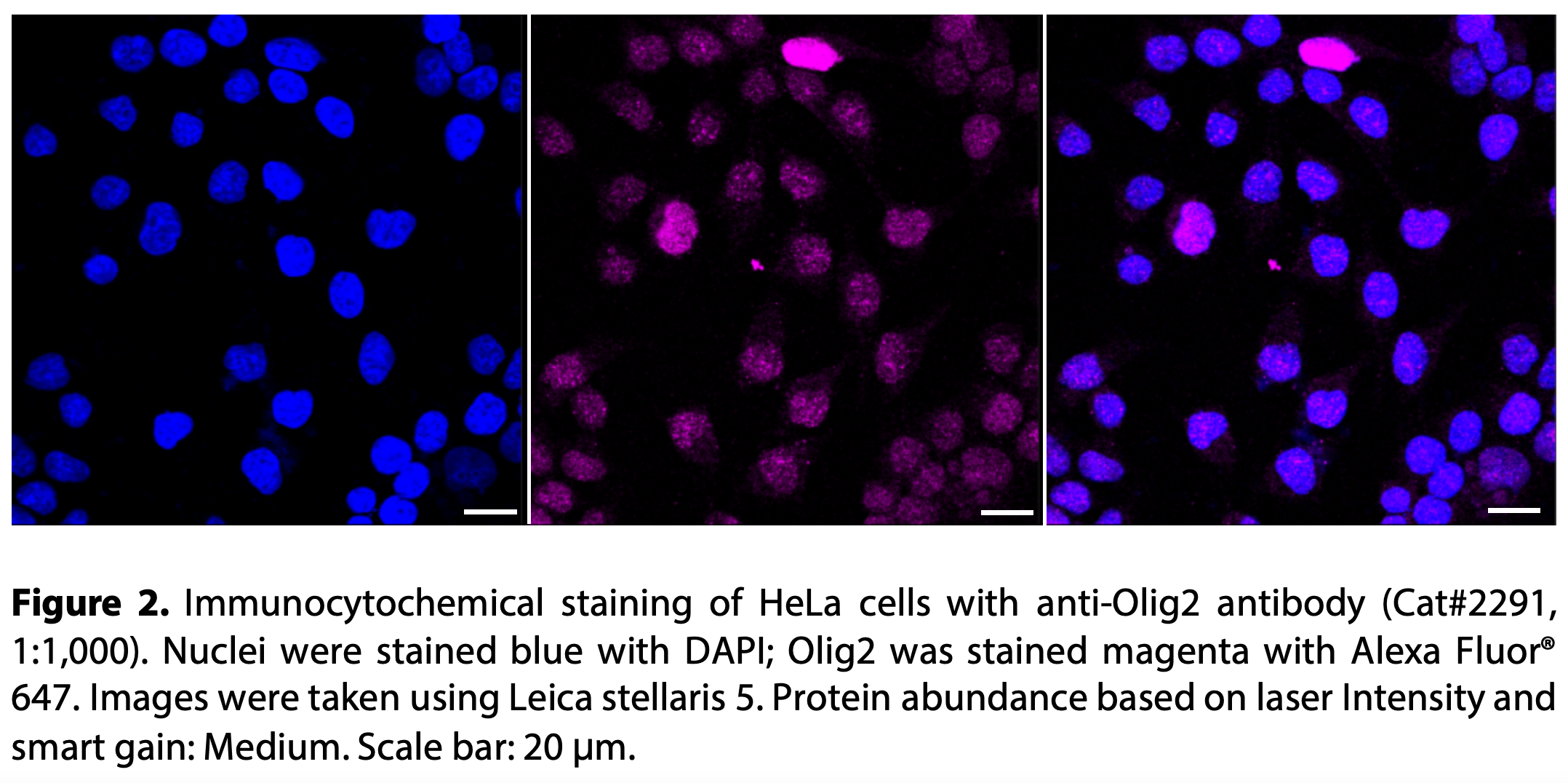 Anti-OLIG2 Rabbit Monoclonal Antibody#2291-合肥善本生物科技有限公司