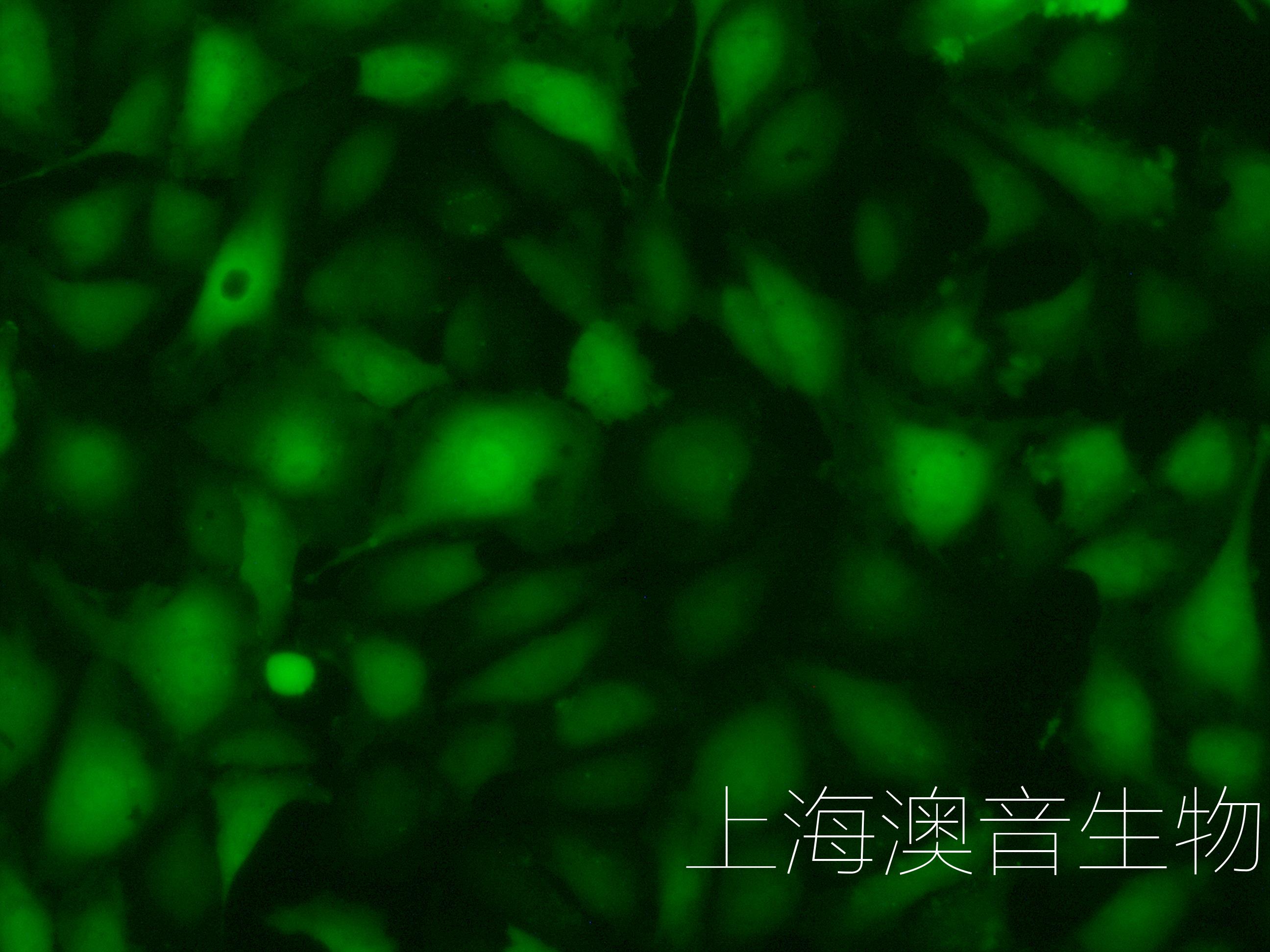 HUVEC-GFP-211107