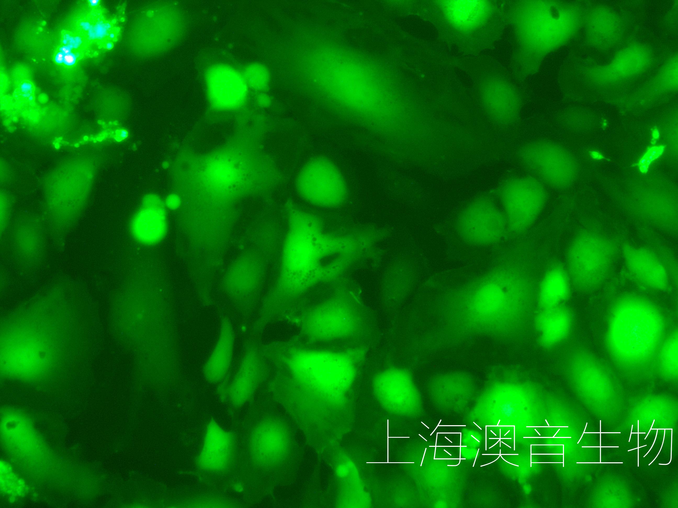 hrmecs-gfp-211110