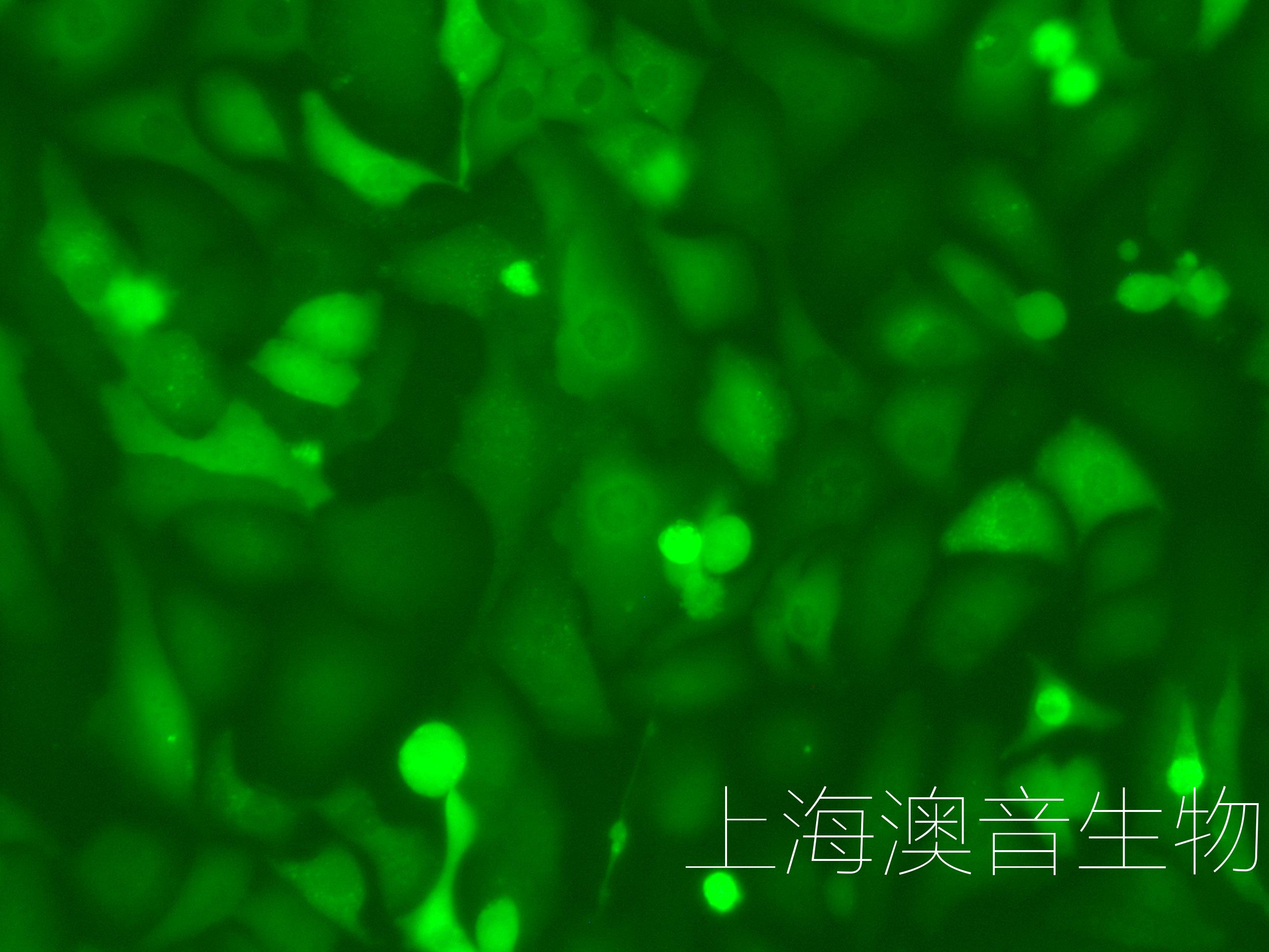 SKOV-3-LUC-GFP-P-220317