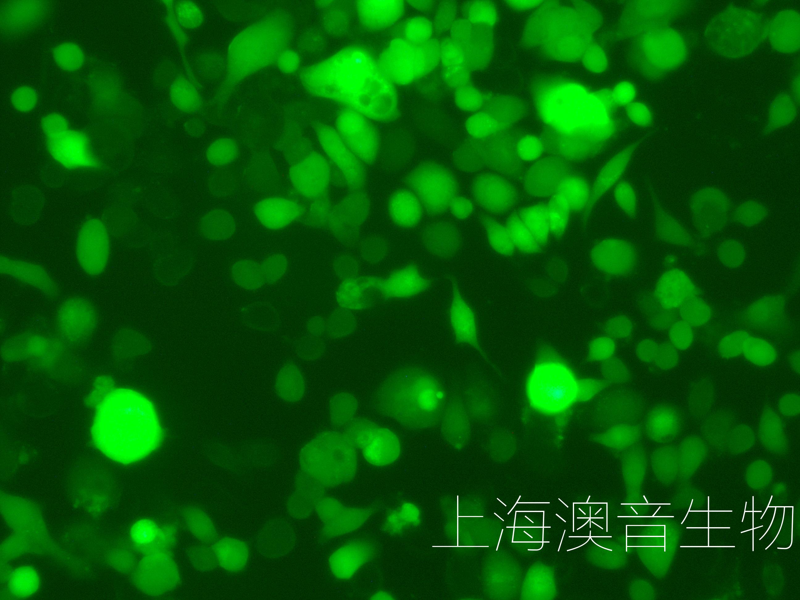 MKN45-GFP-220818-2