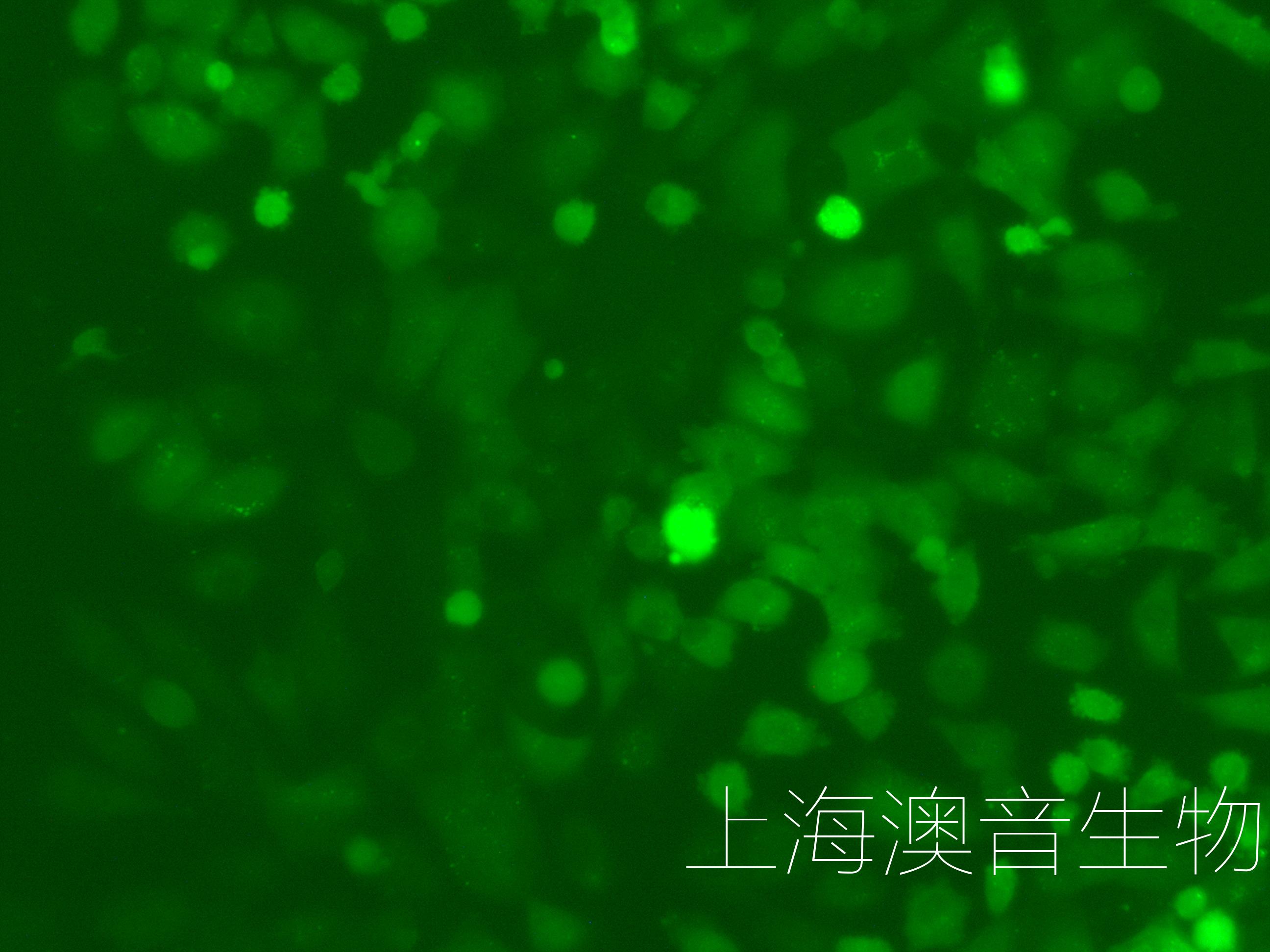 DU145-LUC-GFP-220822