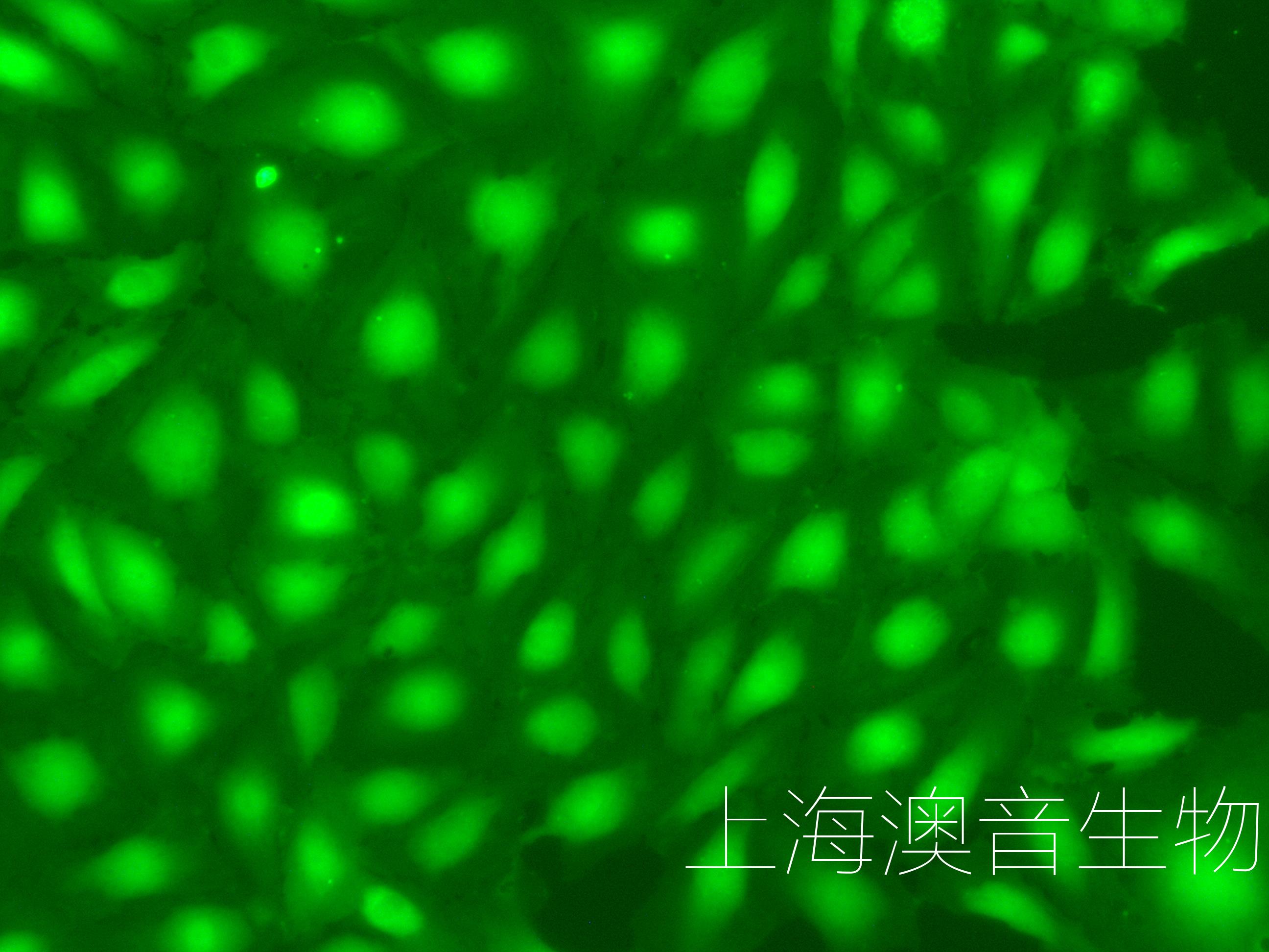 HUVEC-GFP-220813