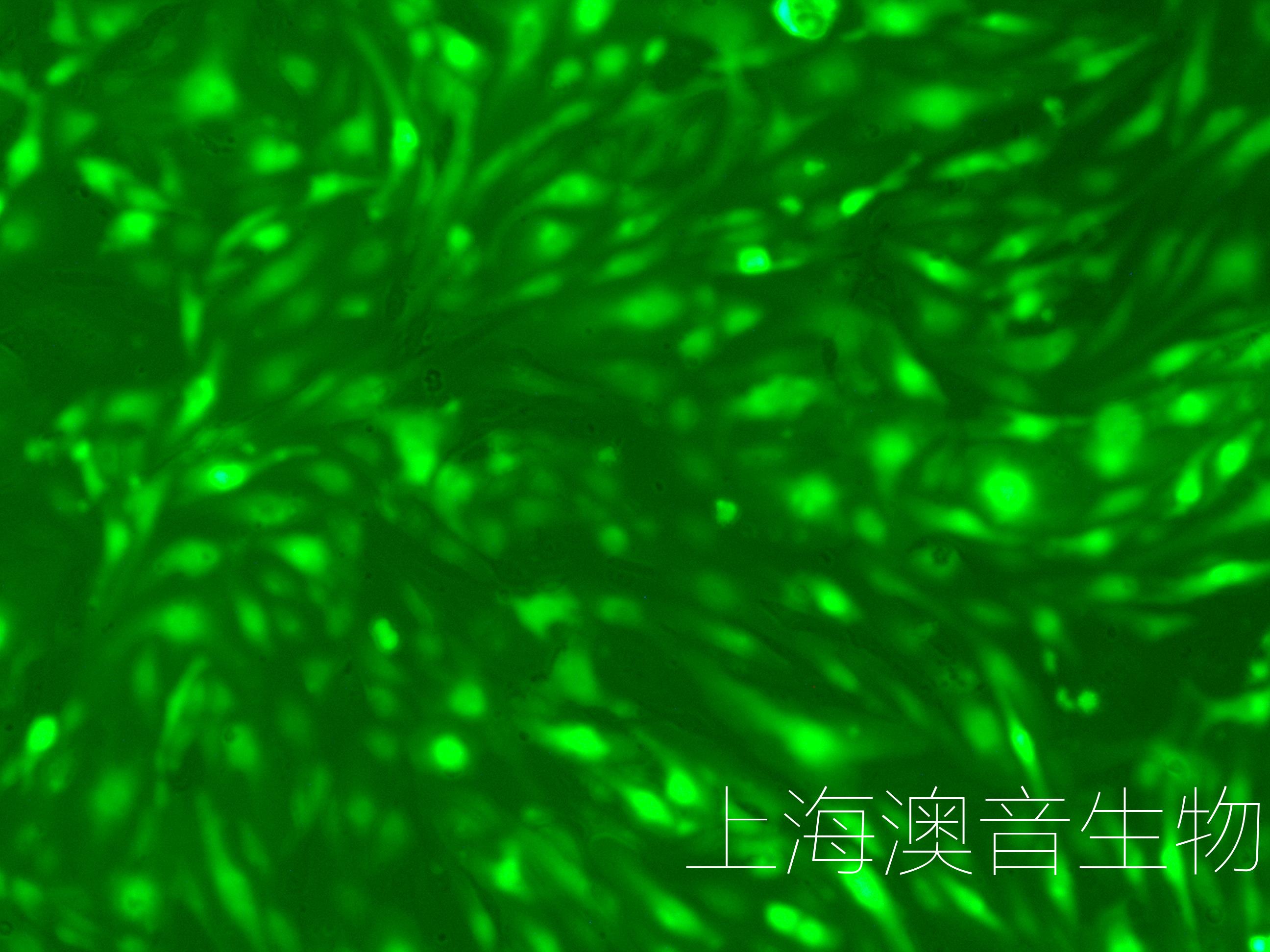 HUVEC-GFP-220809