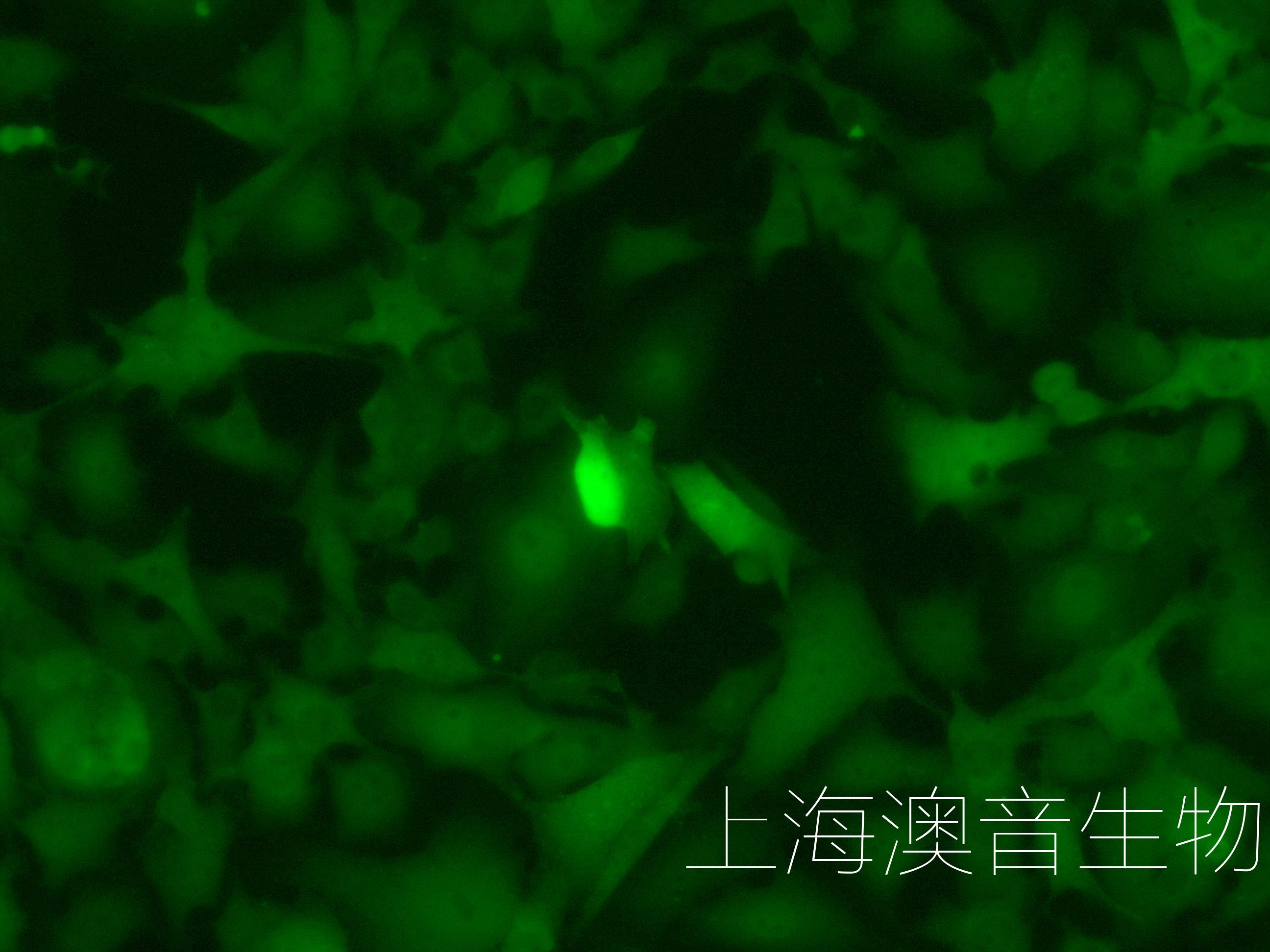 B16F10-LUC-GFP-230203-1