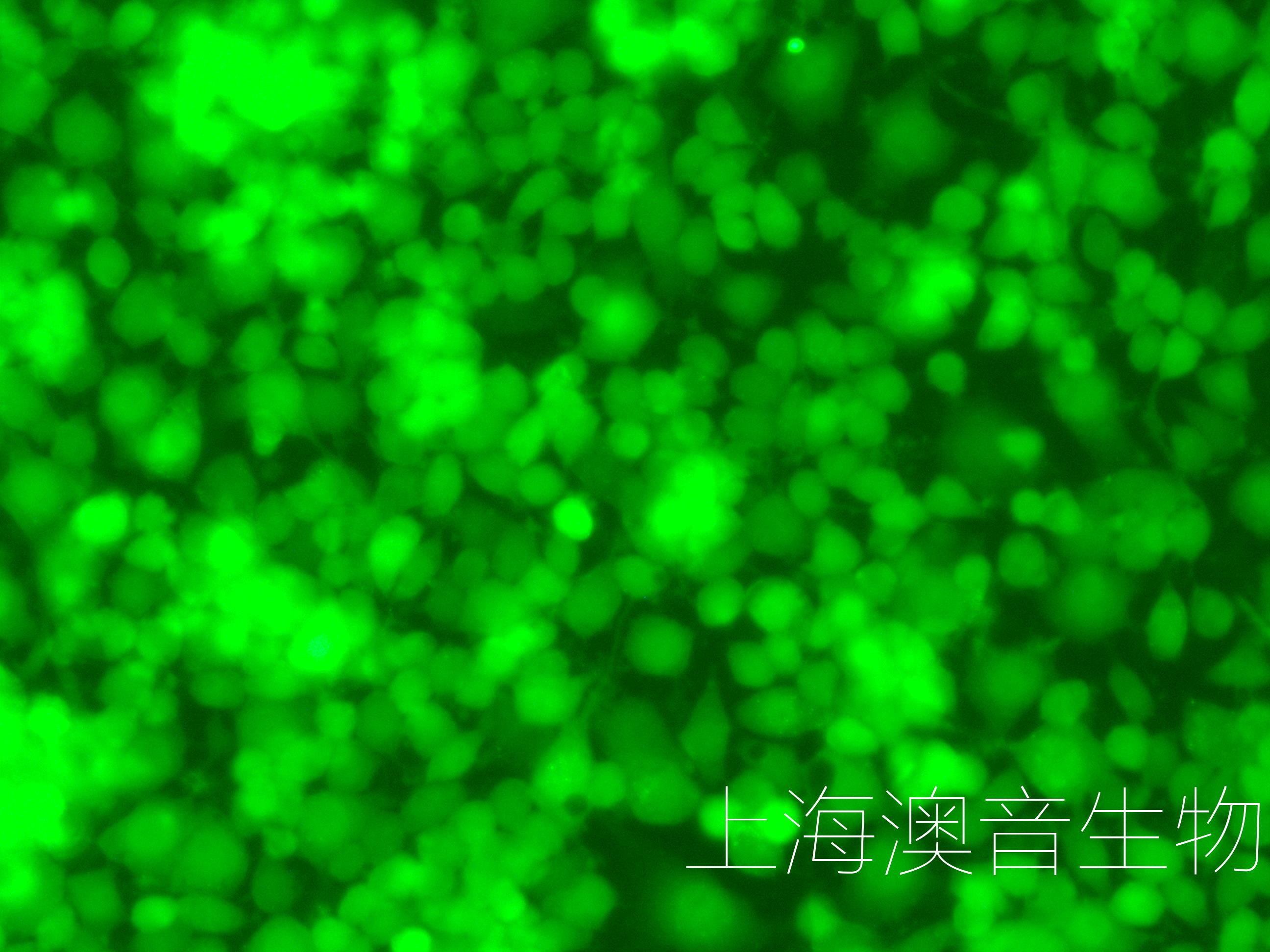 NEURO-2A-GFP-230328-5