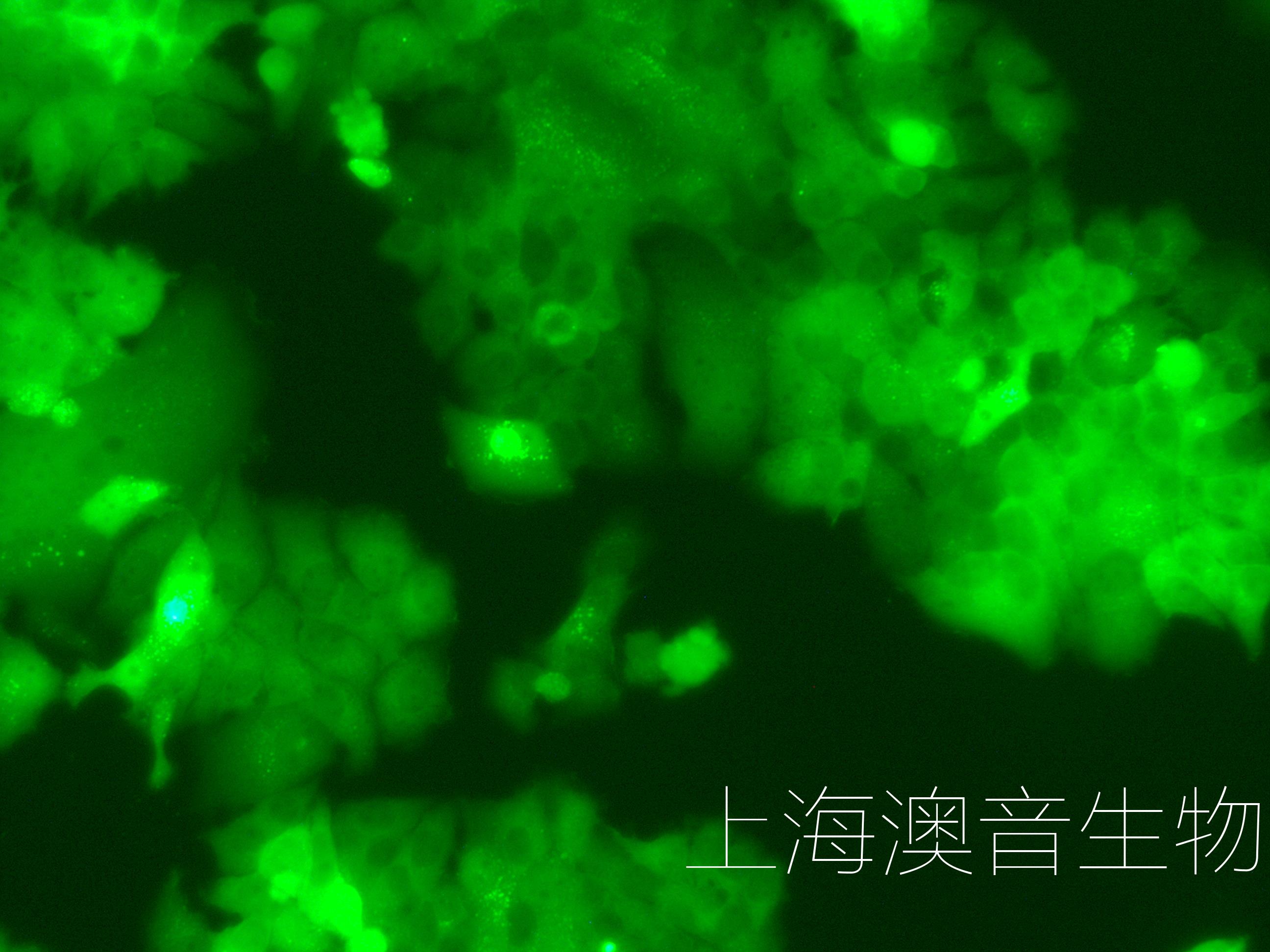 mcf7-luc-gfp-230510-2