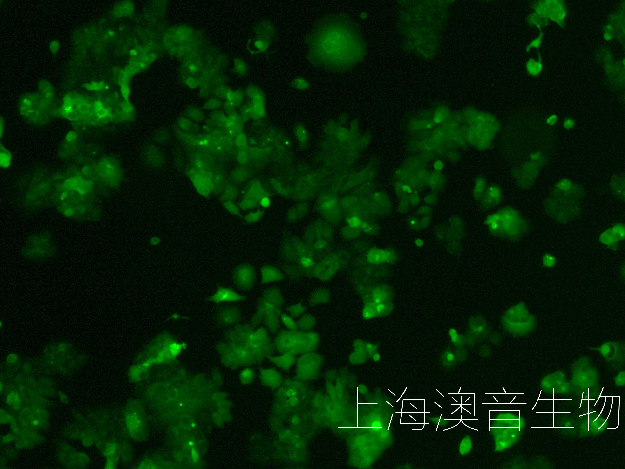 mcf7-luc-gfp-230510-4