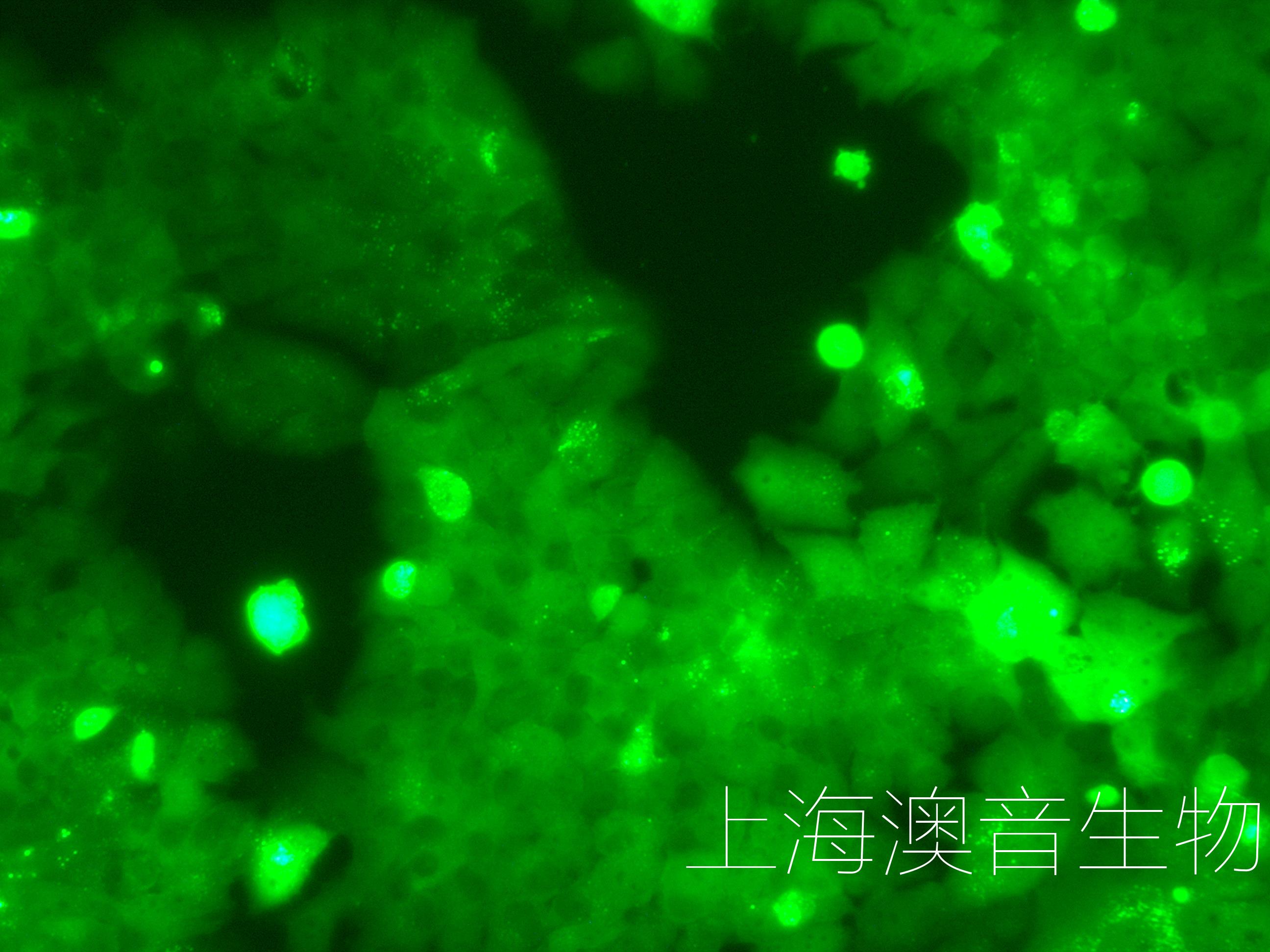 MCF7-LUC-GFP-230512-2