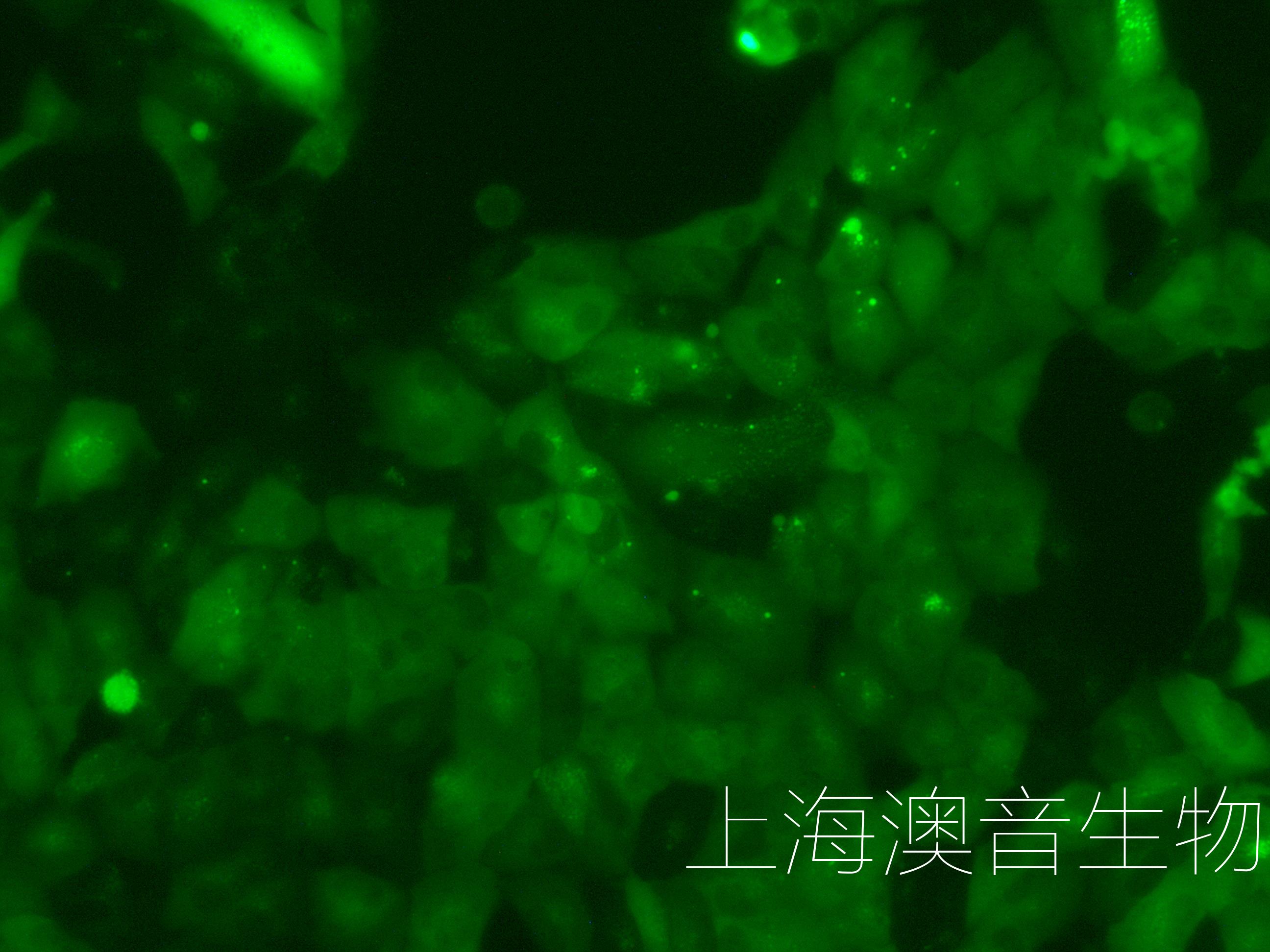 ACHN-LUC-GFP-230610-1