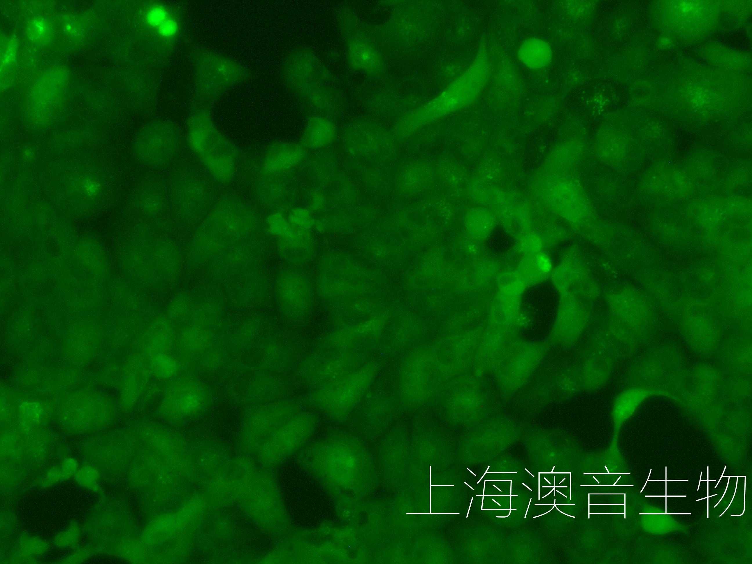 ACHN-LUC-GFP-230610-3