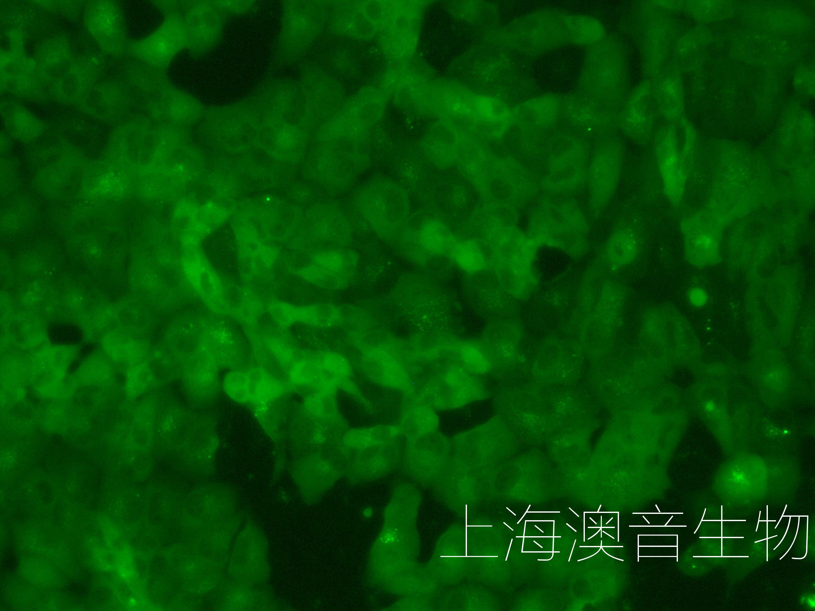 ACHN-LUC-GFP-230610-4