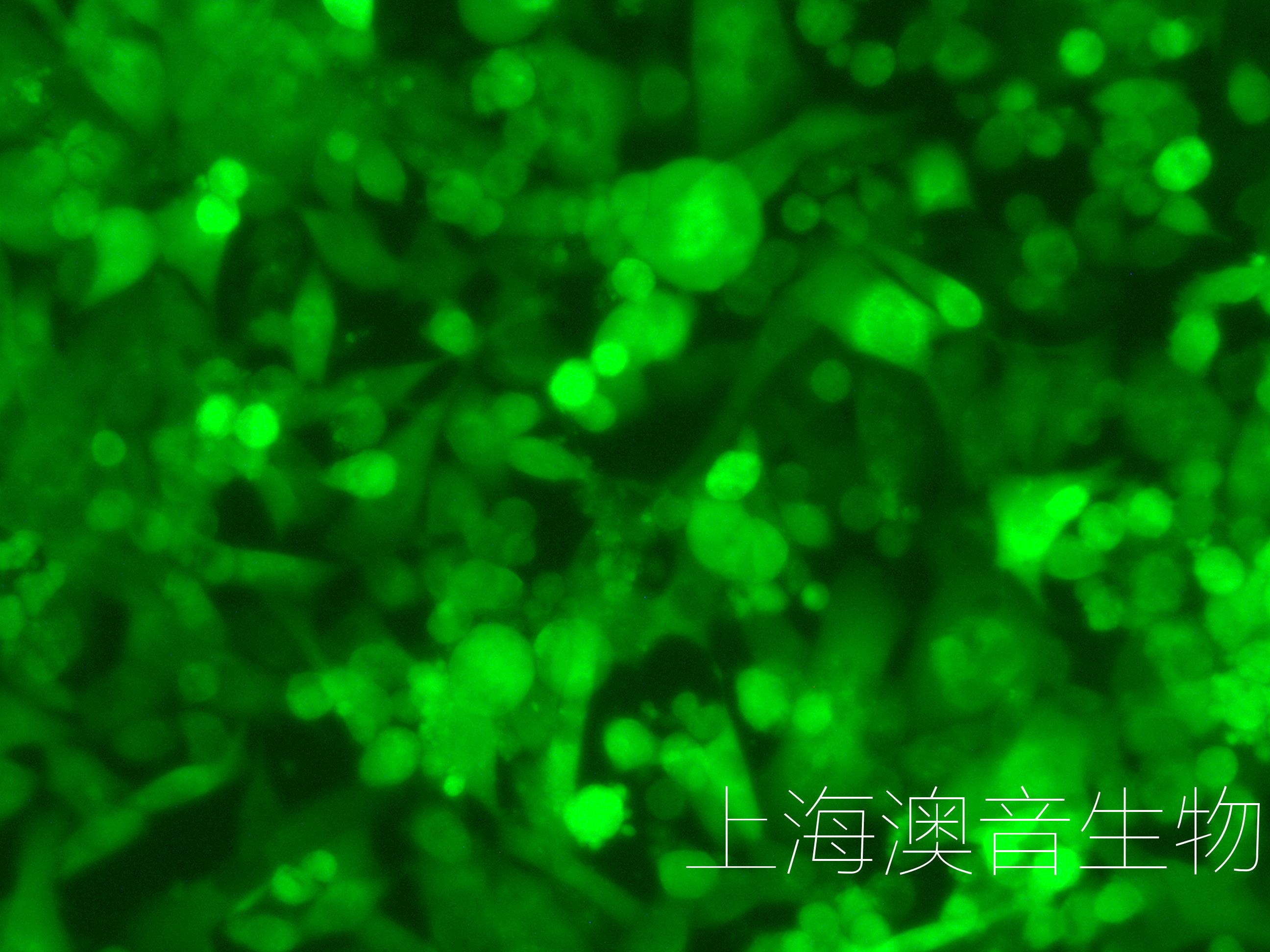 BT549-LUC-GFP-230814