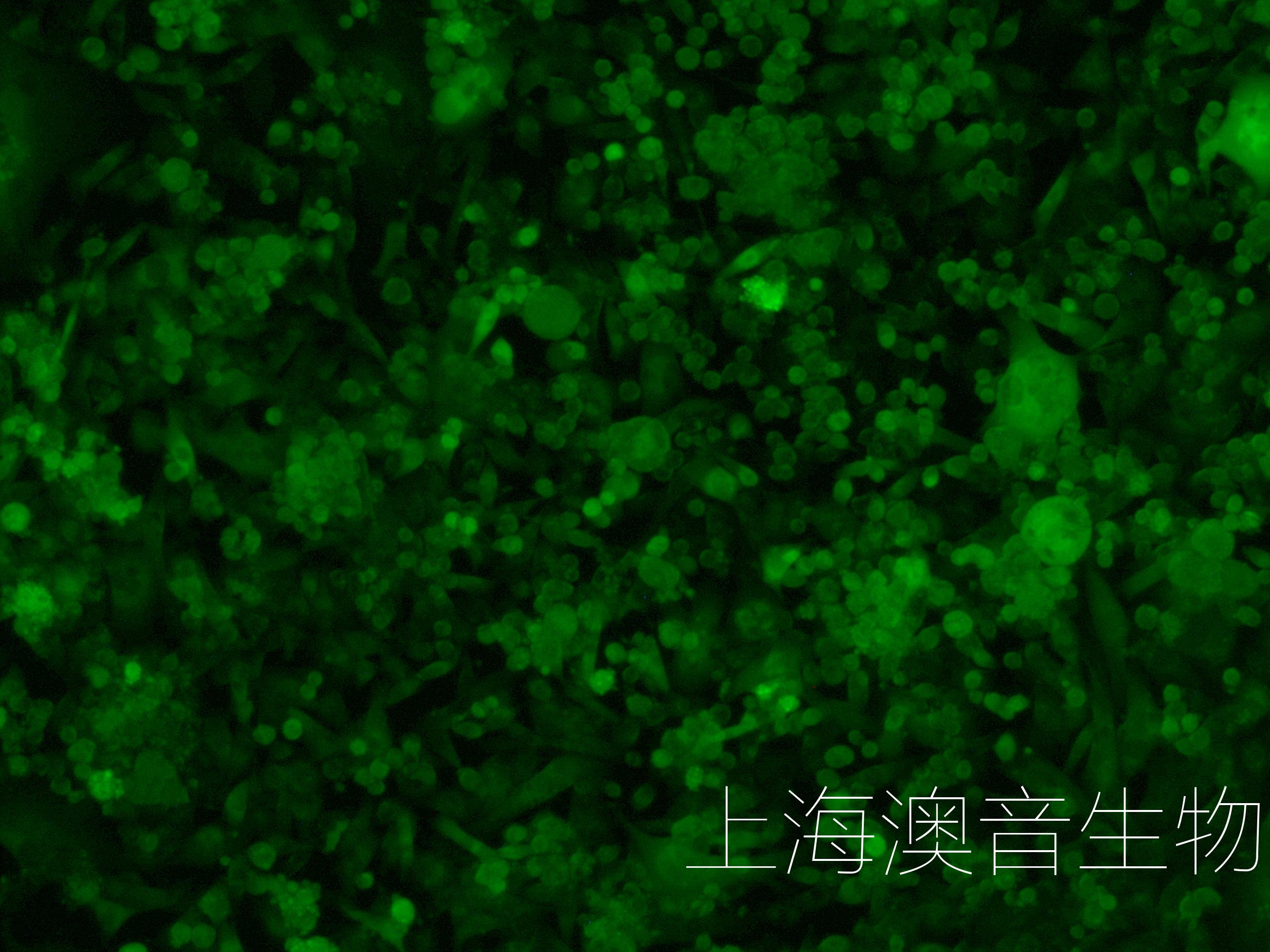 BT549-LUC-GFP-230814-1