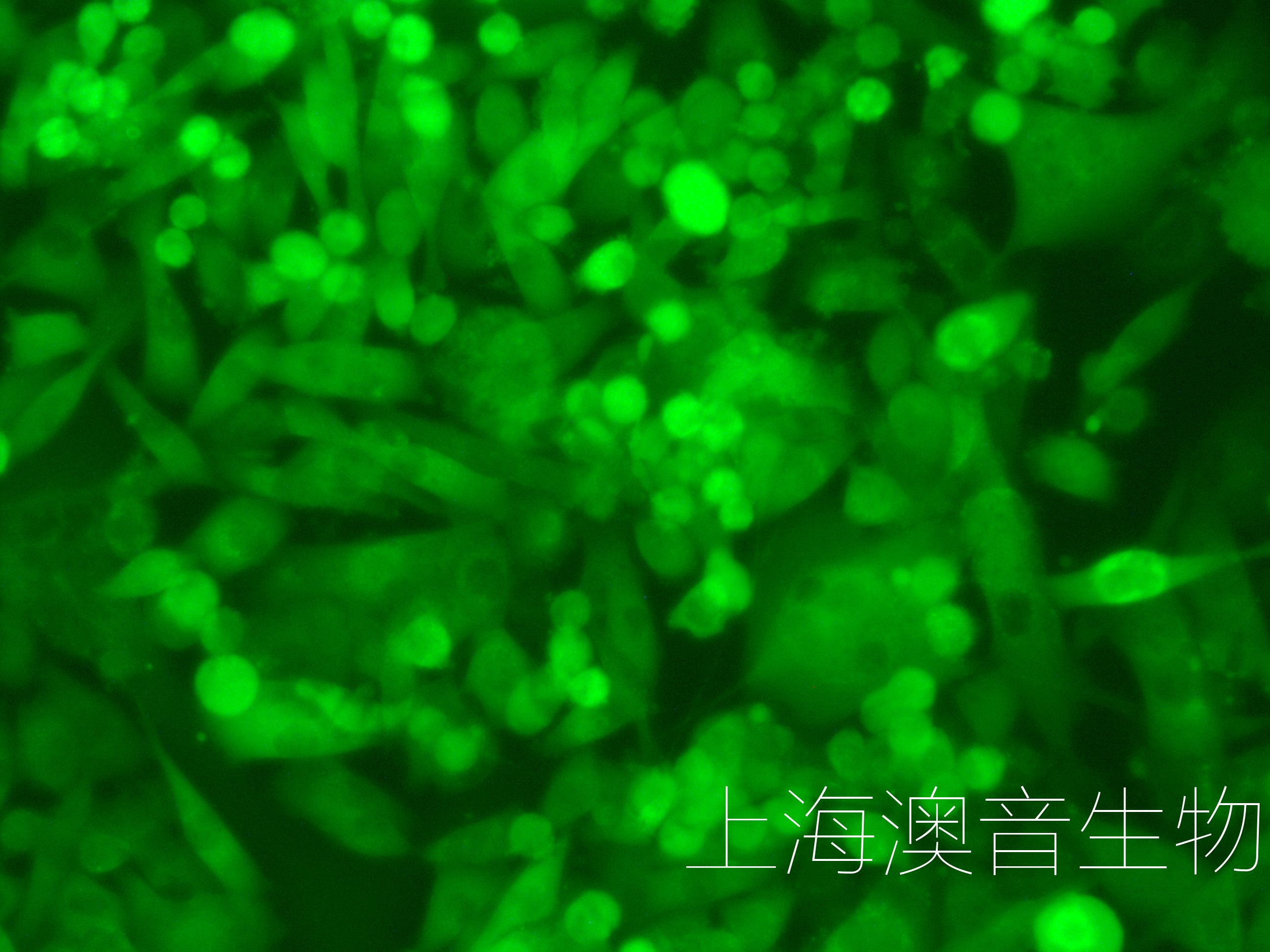 BT549-LUC-GFP-230814-2