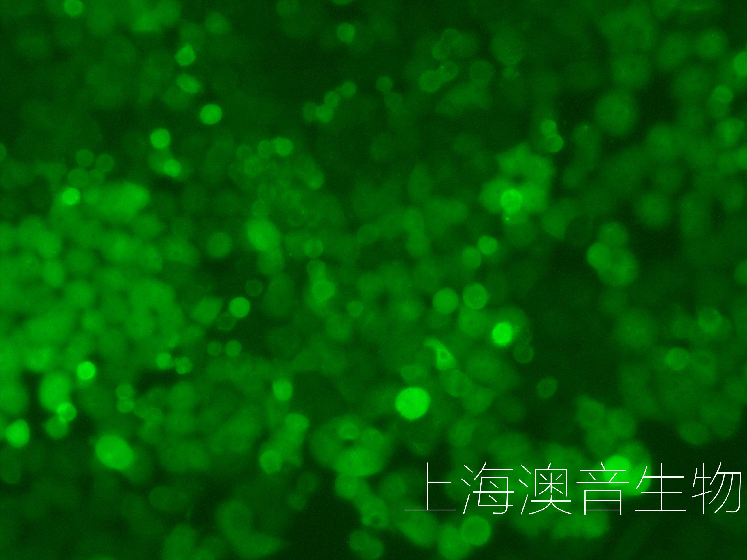 MDA-MB-468-LUC-GFP-230813-2