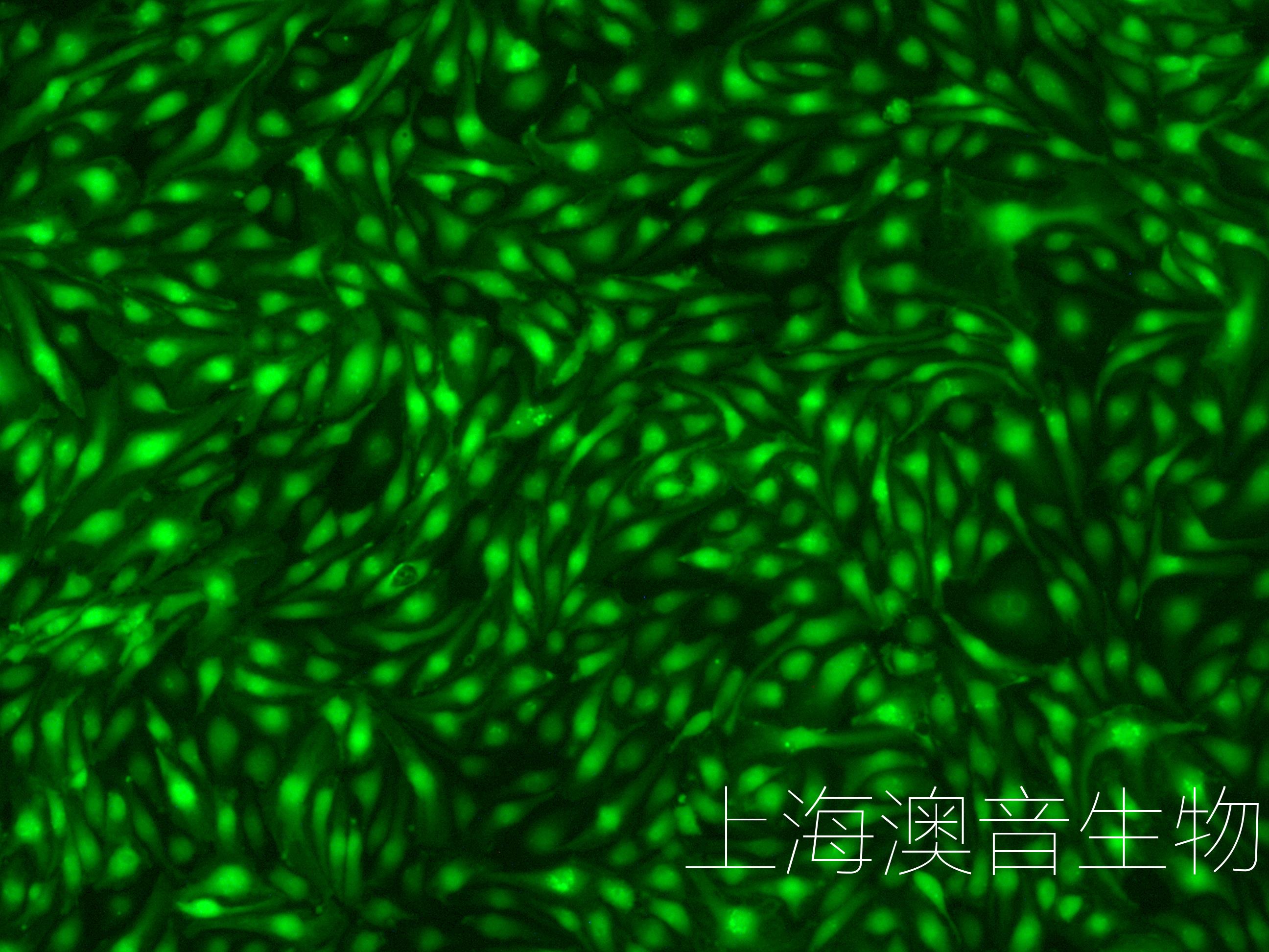 HUVEC-GFP-230818-5