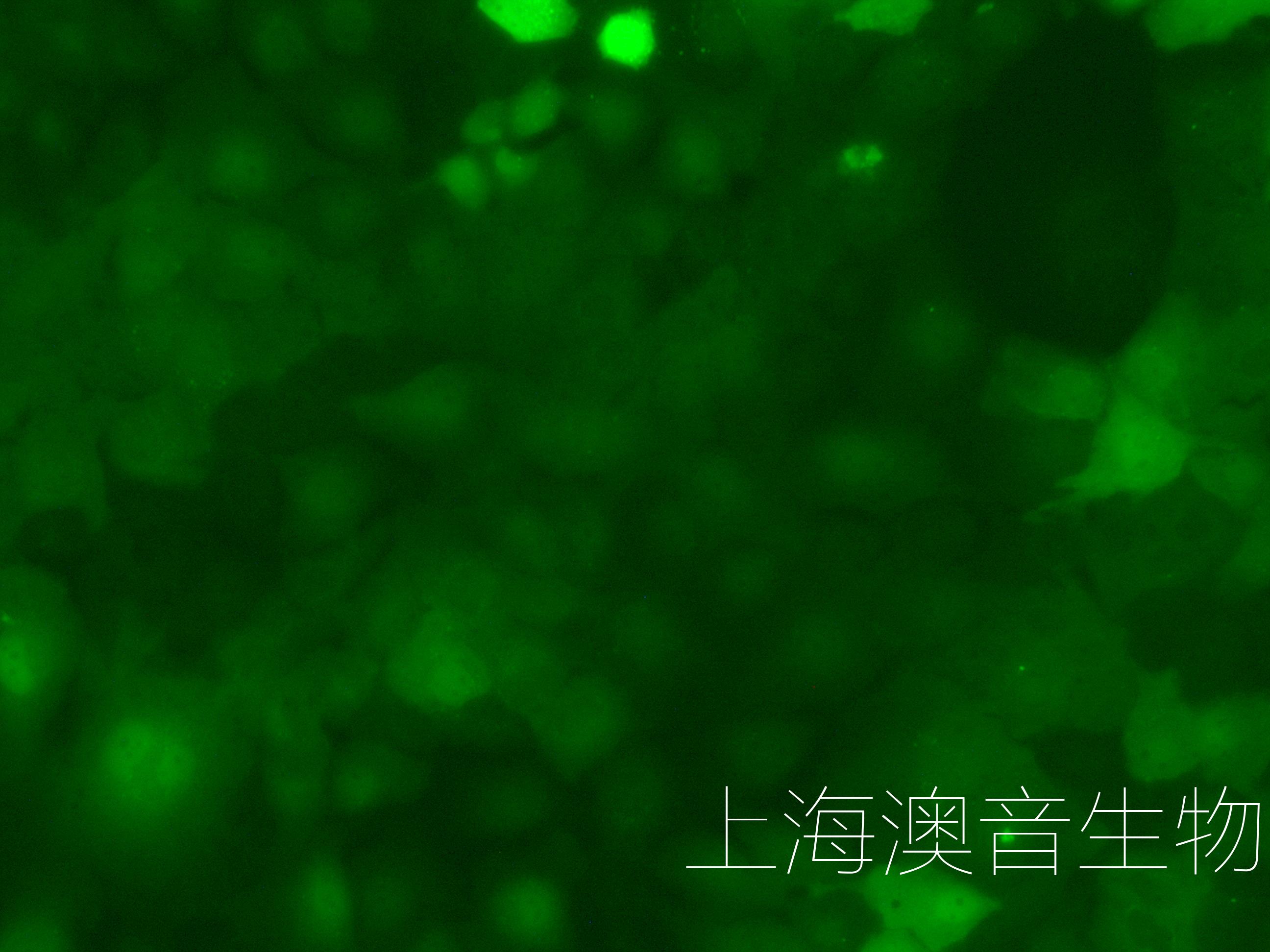 HUH7-GFP-231010-4