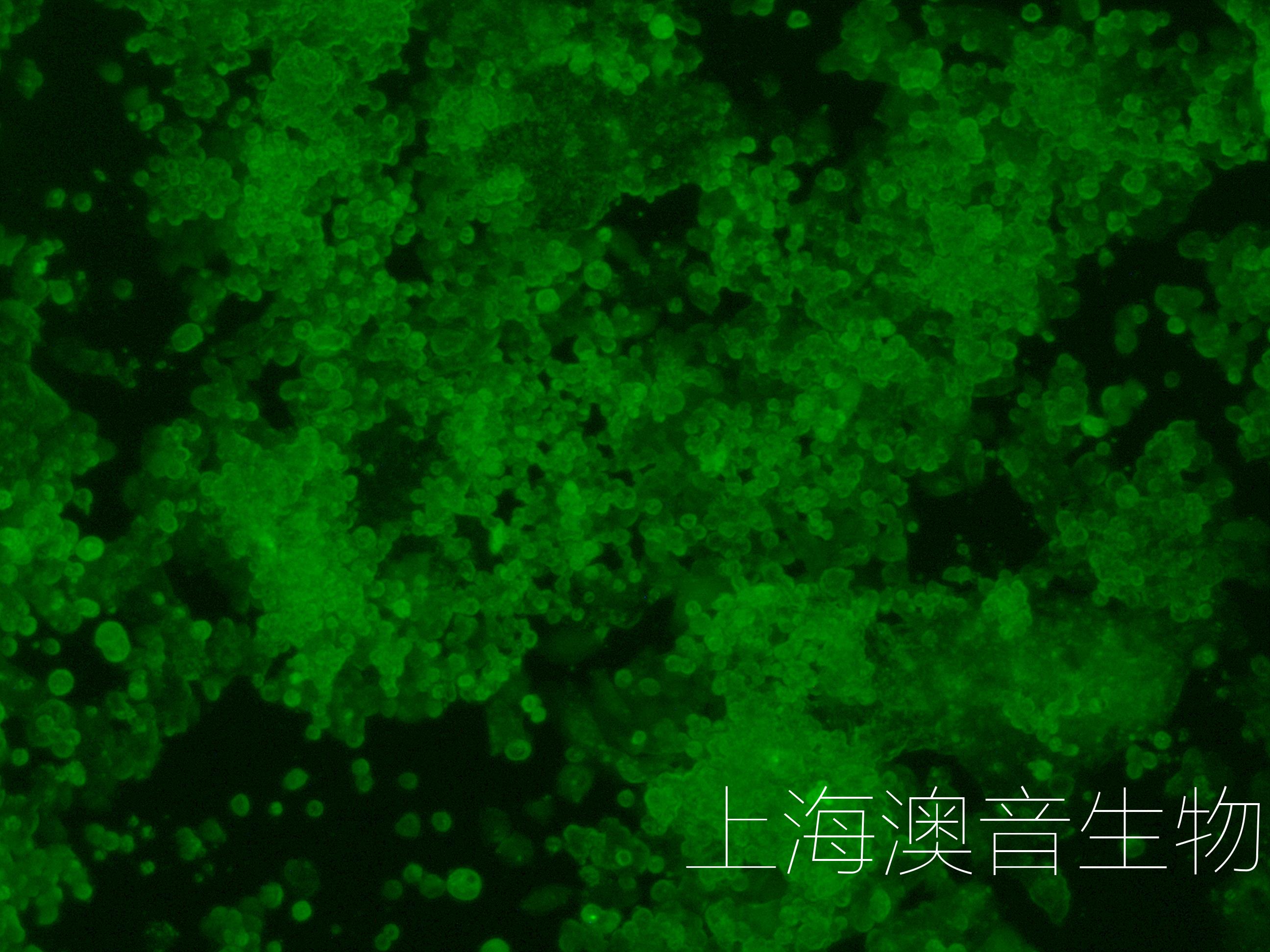 A2780-LUC-GFP-240316-4