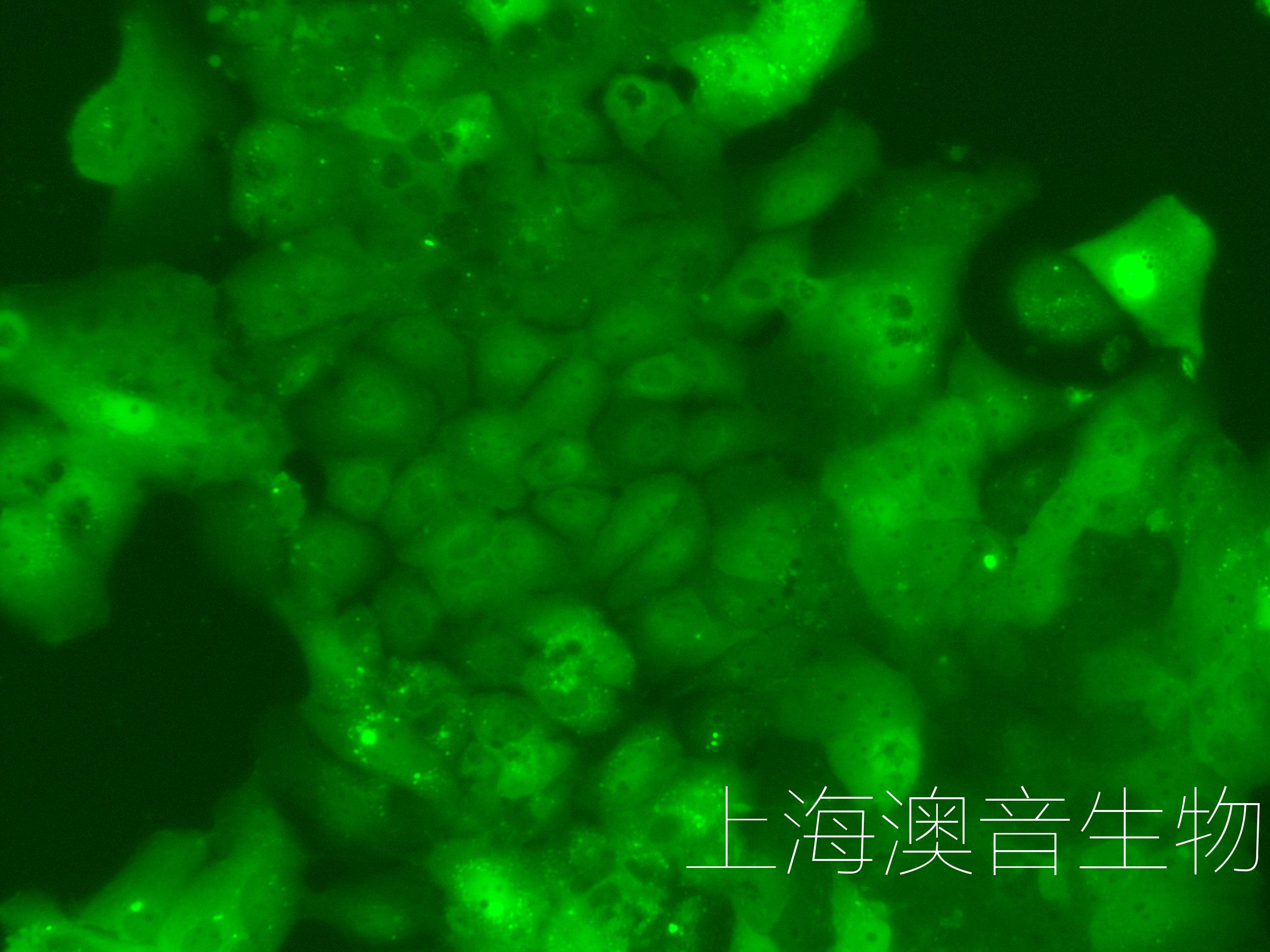 HUH7-LUC-GFP-240404-1