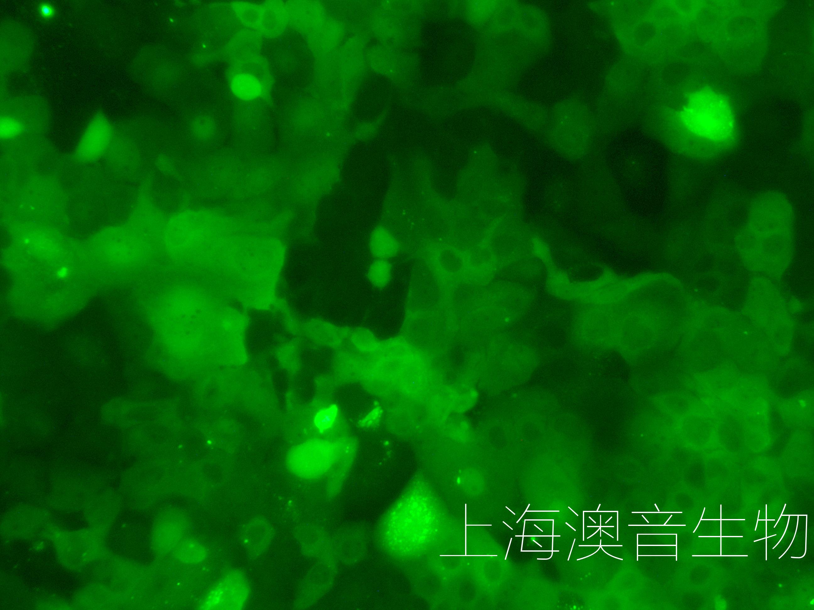 HUH7-LUC-GFP-240412-4