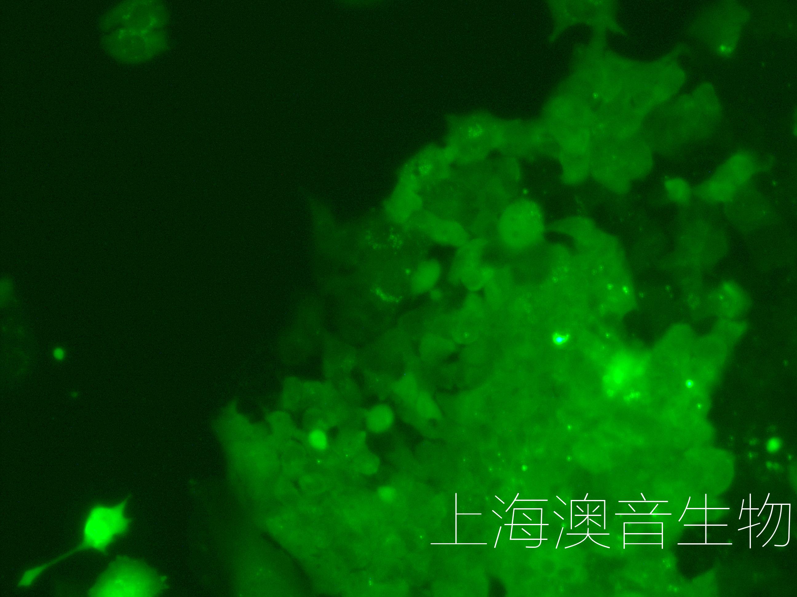 OV90-LUC-GFP-240406