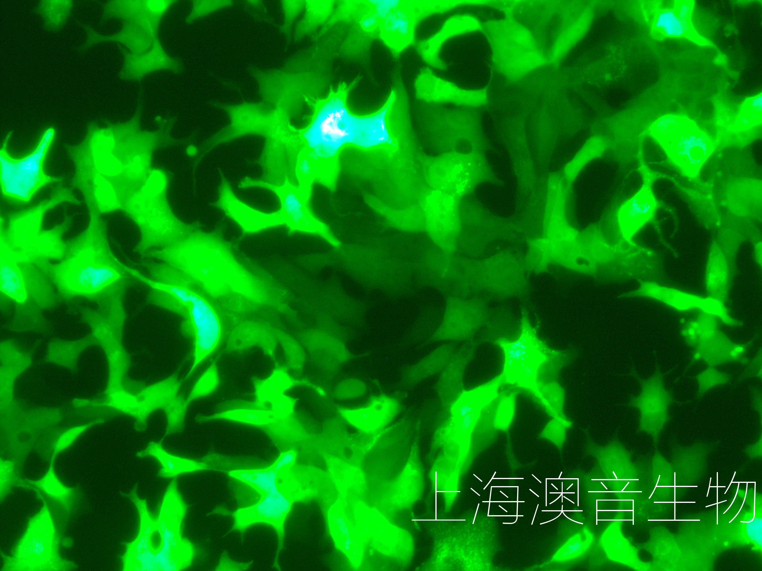 22RV1-LUC-GFP-240512-4