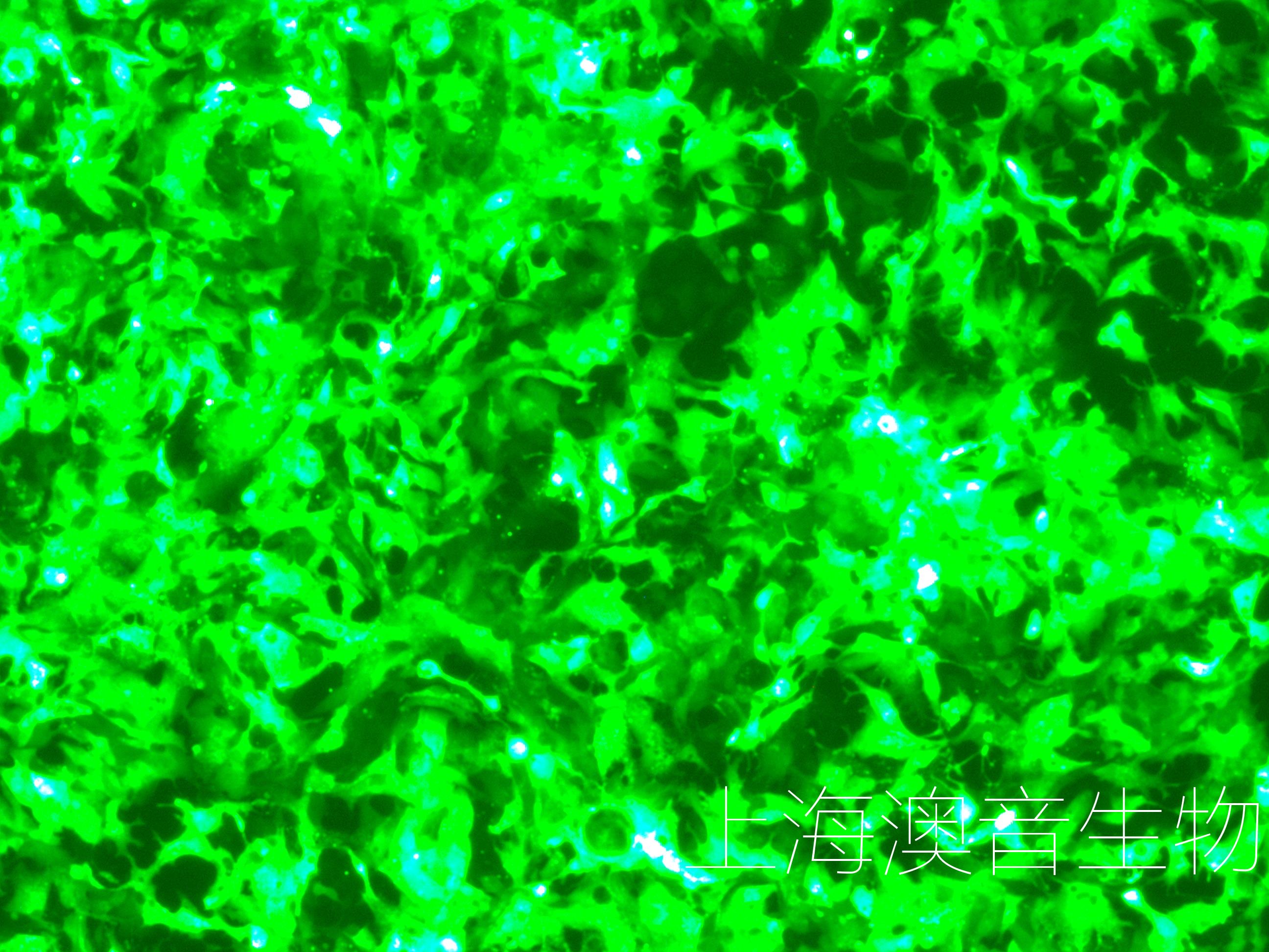 22RV1-LUC-GFP-240517