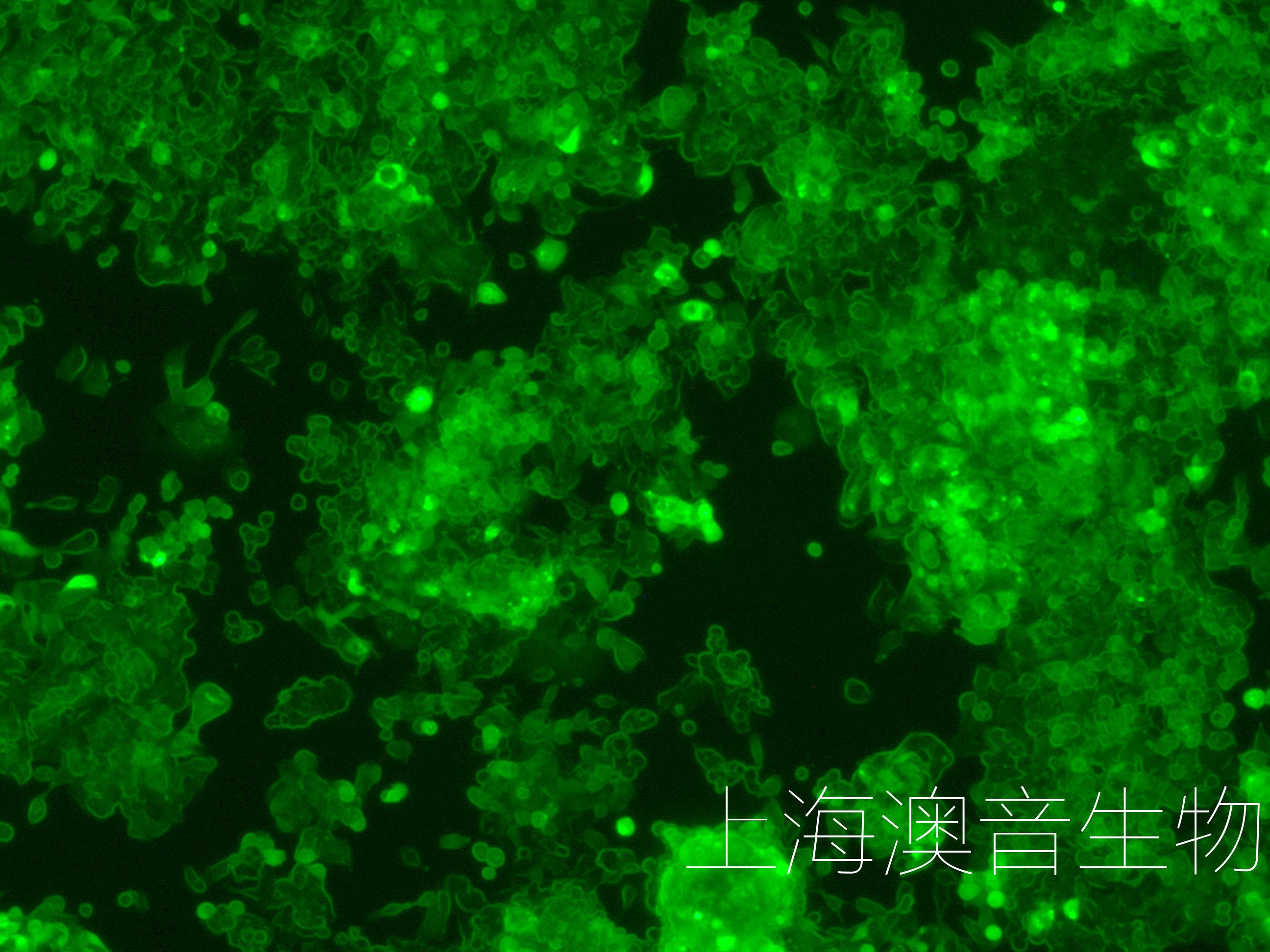 LS174T-LUC-GFP-240519-2