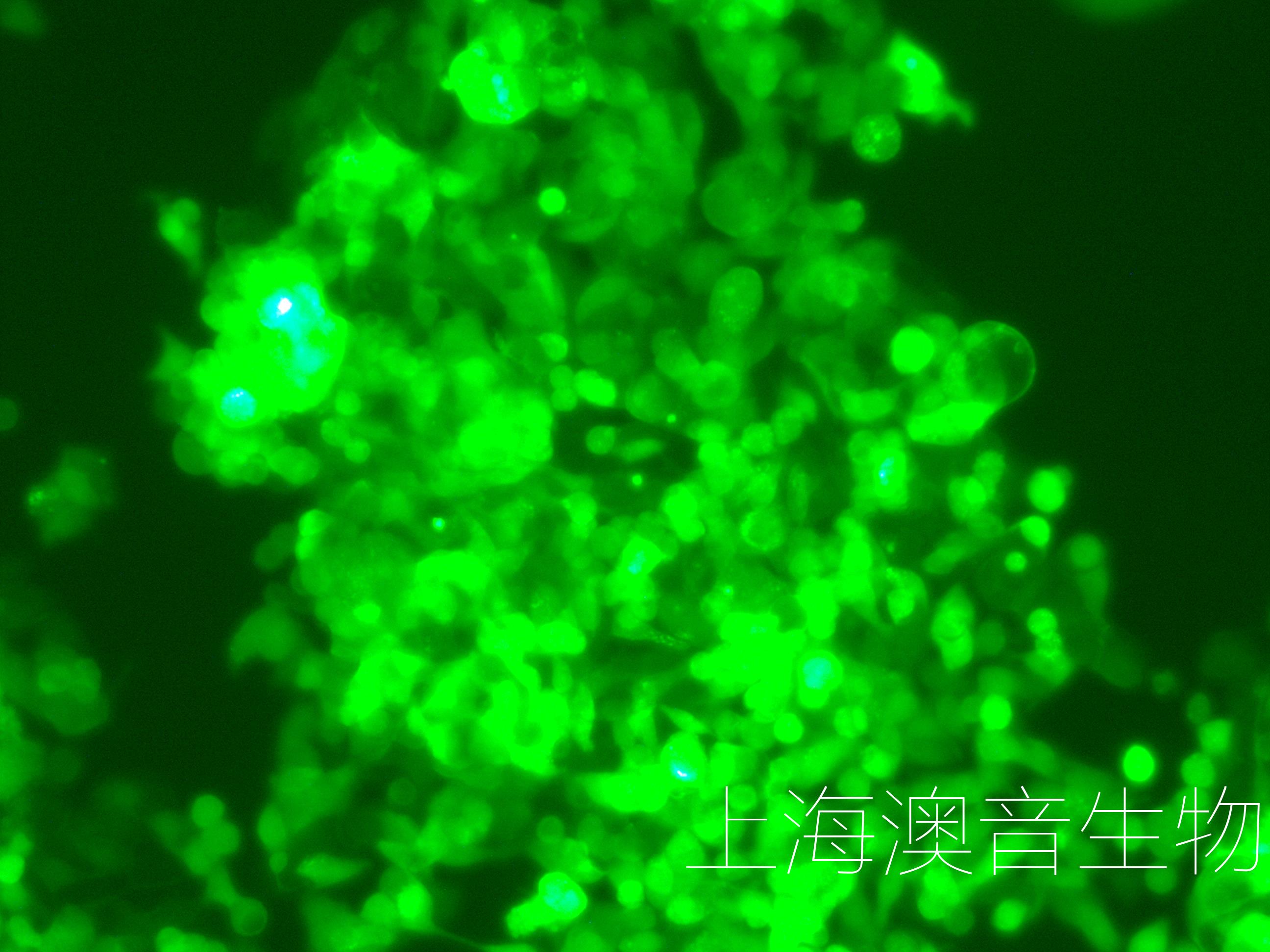 LS174T-LUC-GFP-240519-3