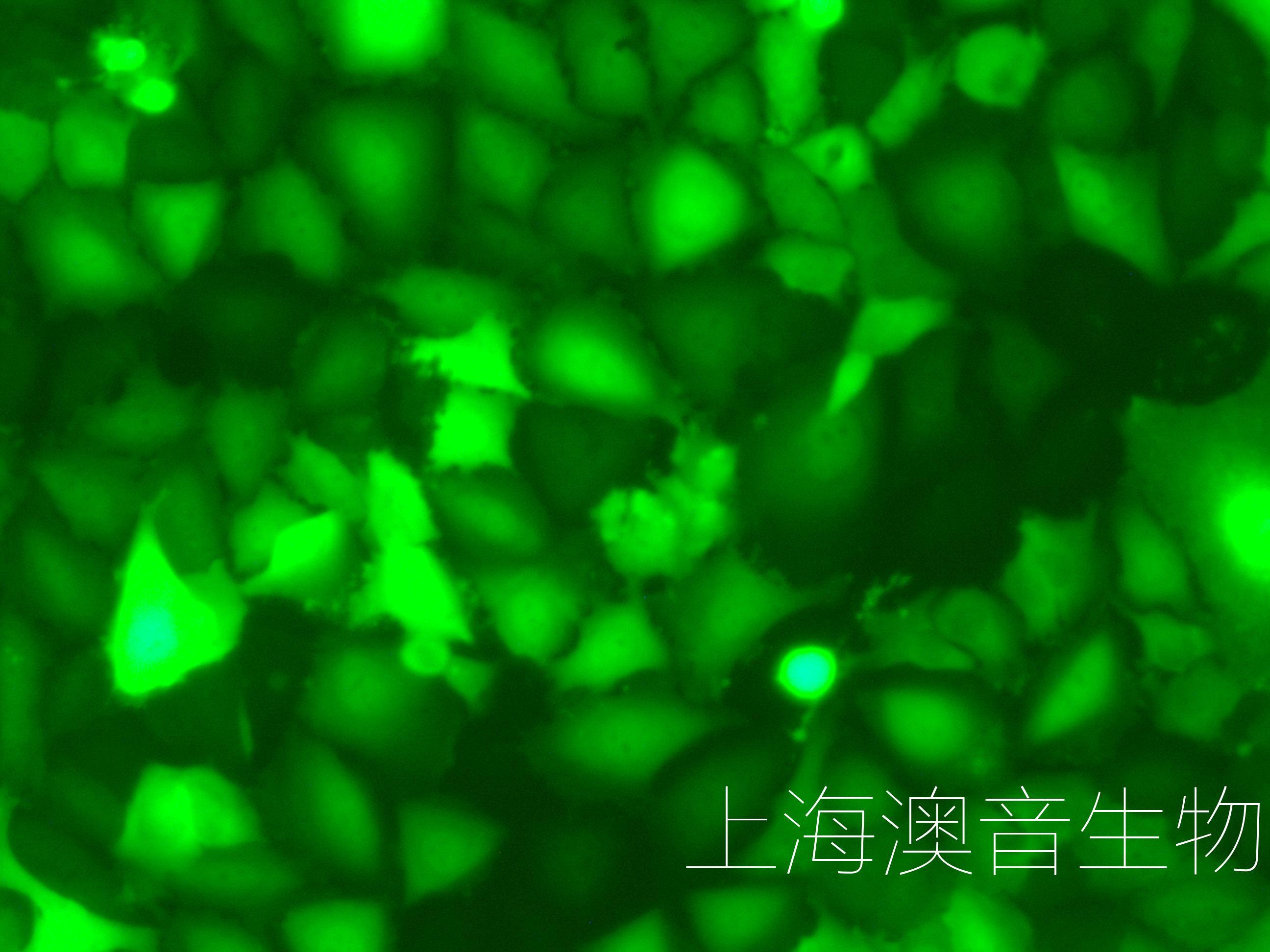 J82-LUC-GFP-240609-2