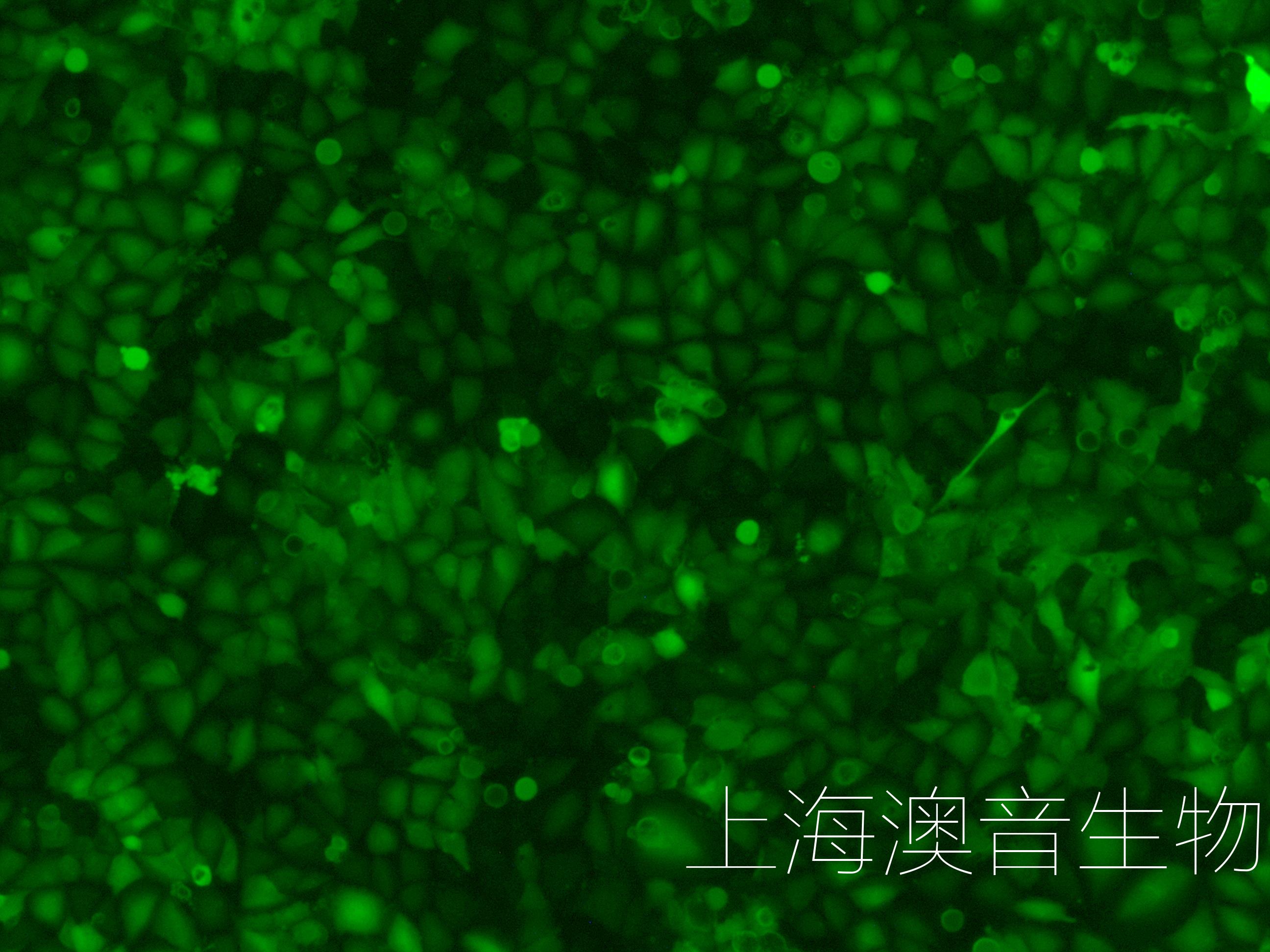 J82-LUC-GFP-240609-4