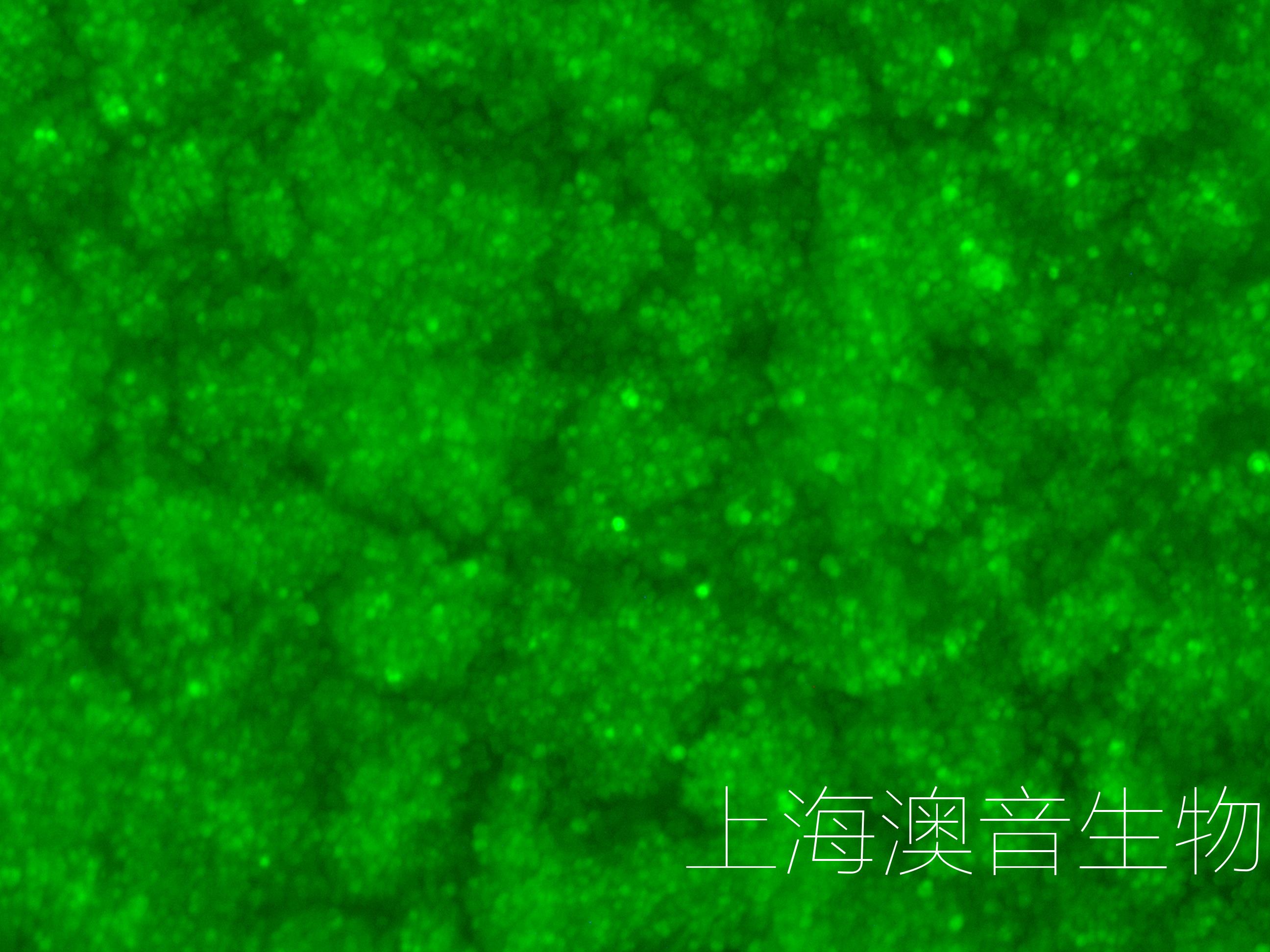 RAJI-LUC-GFP-240620