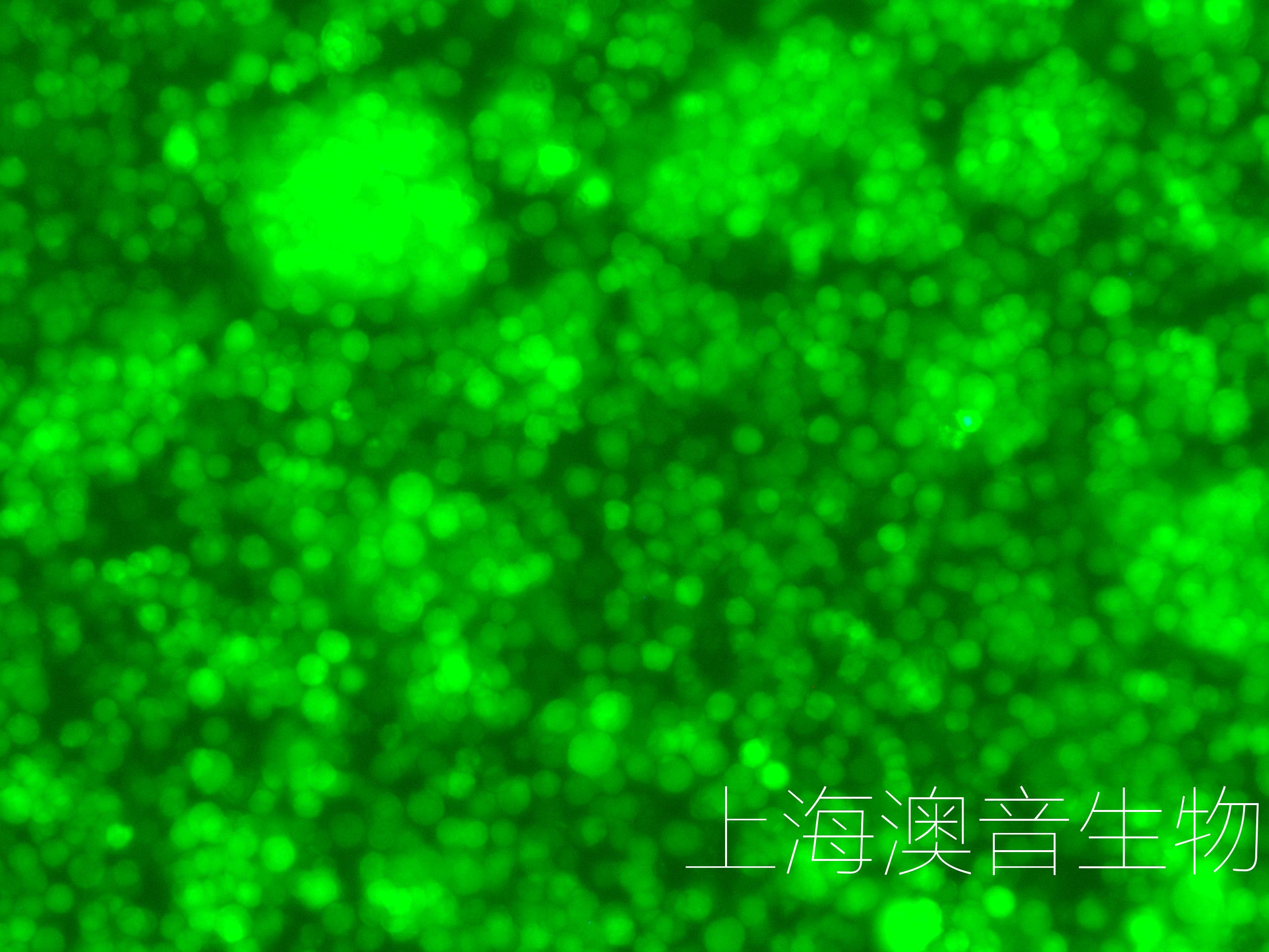 RAJI-LUC-GFP-240623-1