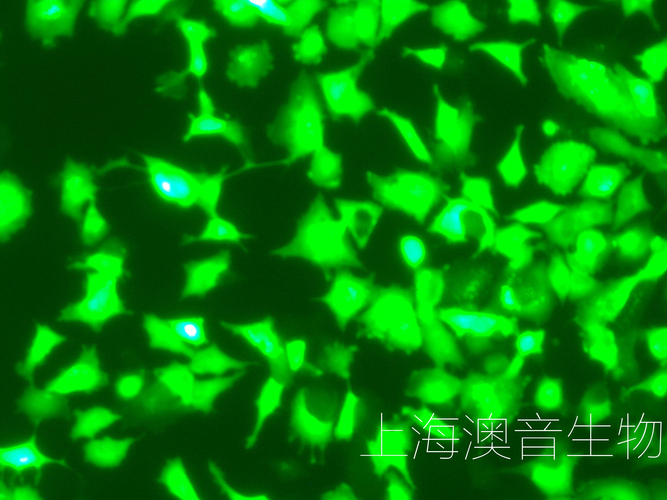 SH-SY5Y-LUC-GFP-240625