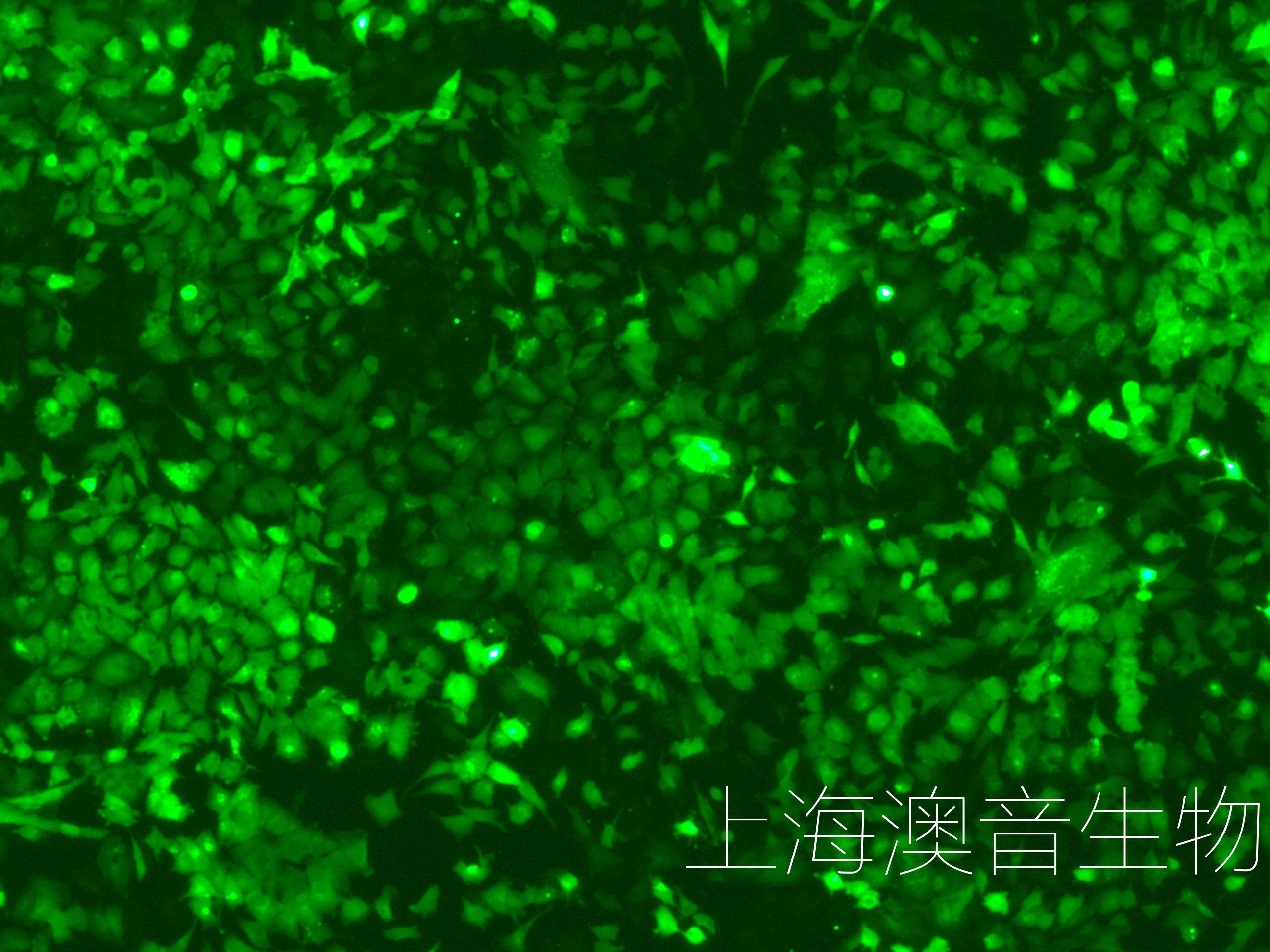 SH-SY5Y-LUC-GFP-240628-1