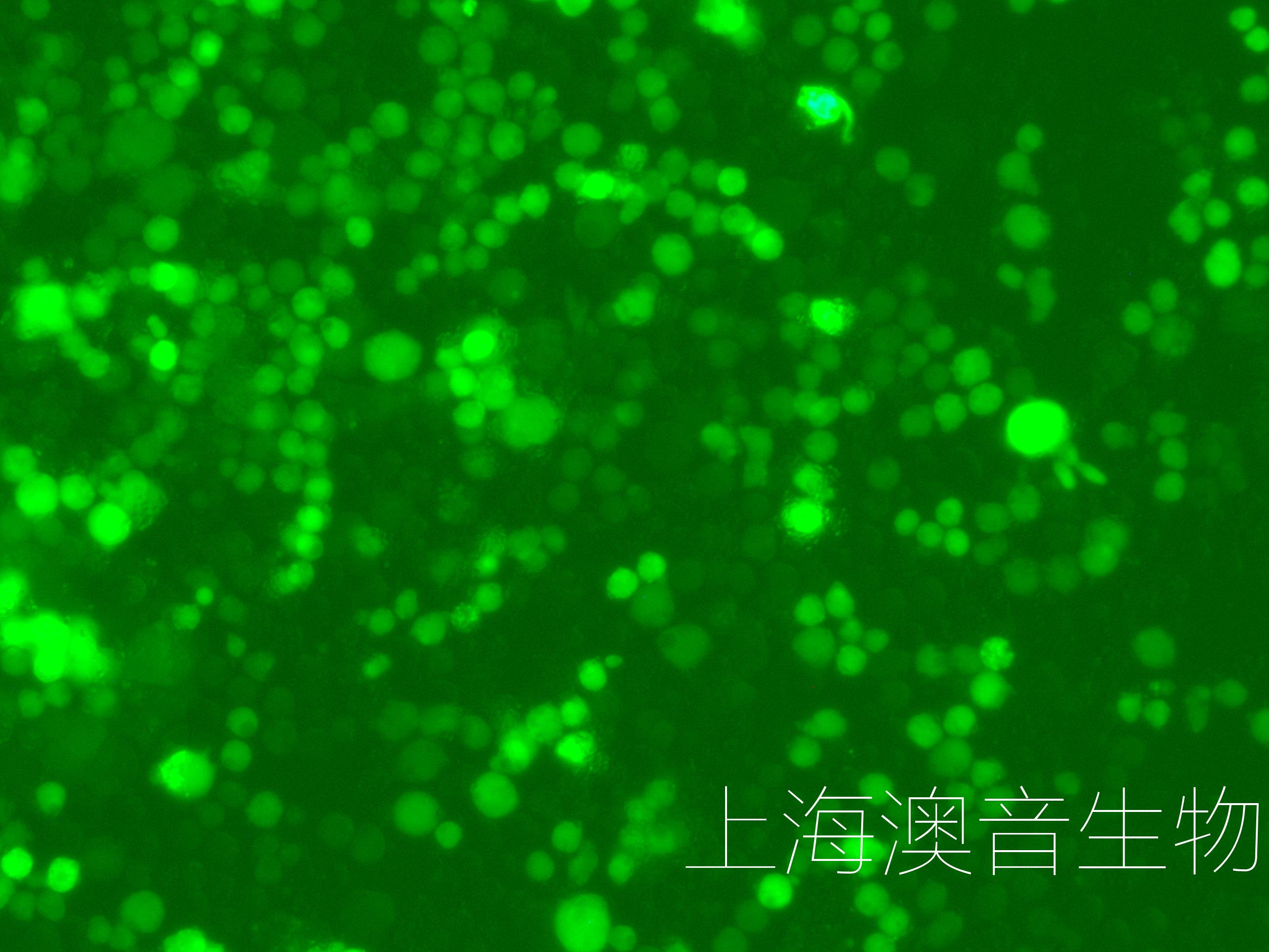 U266-LUC-GFP-240701