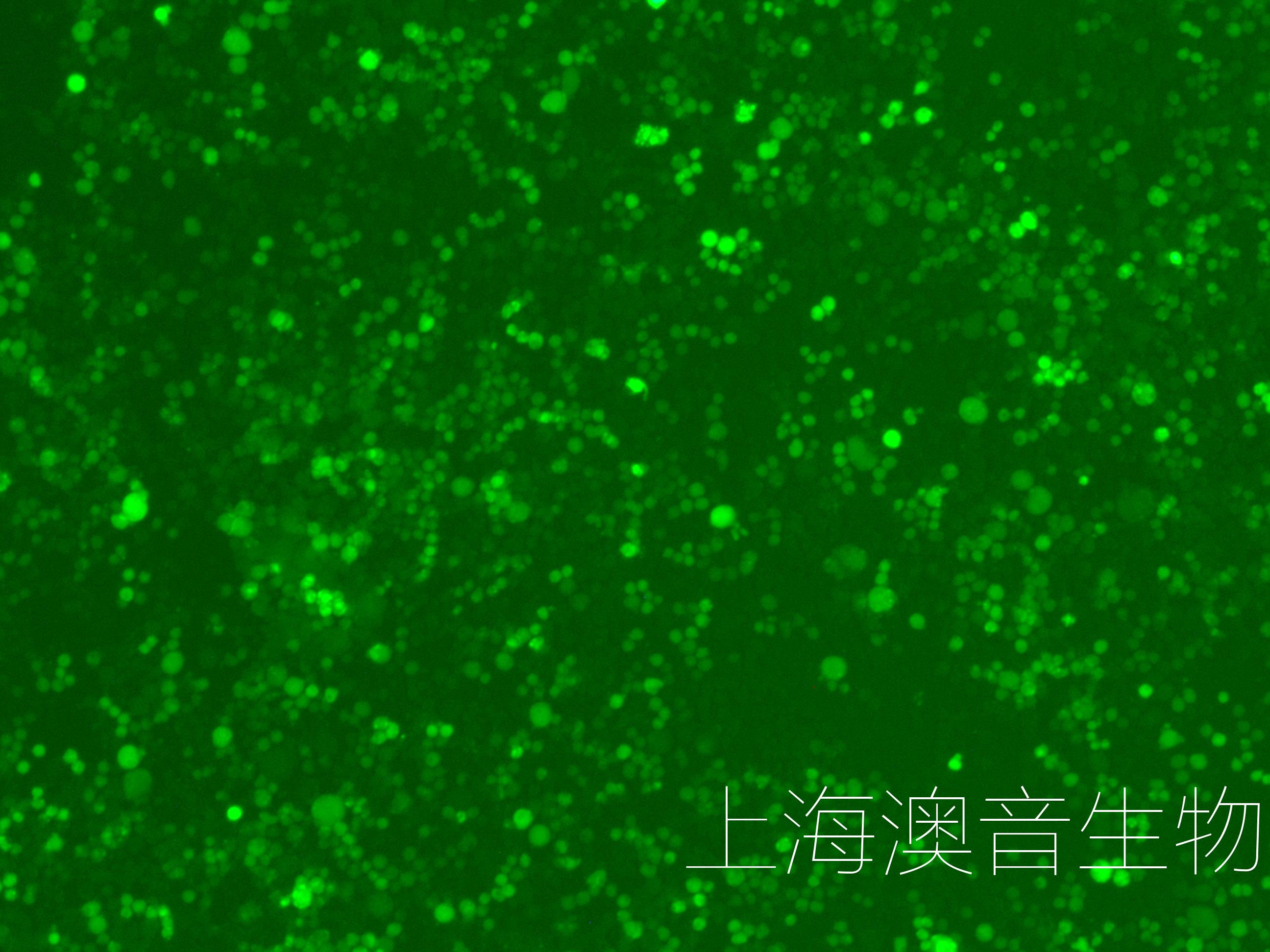 U266-LUC-GFP-240701-1