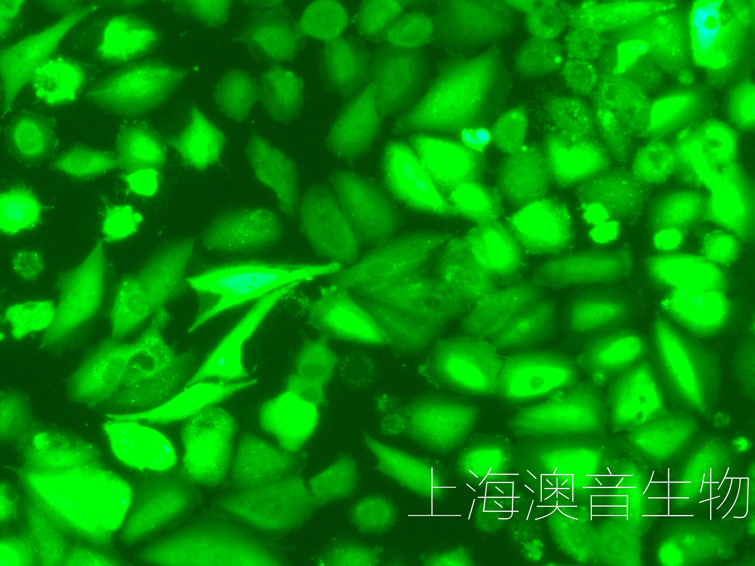 SAOS-2-LUC-GFP-240713