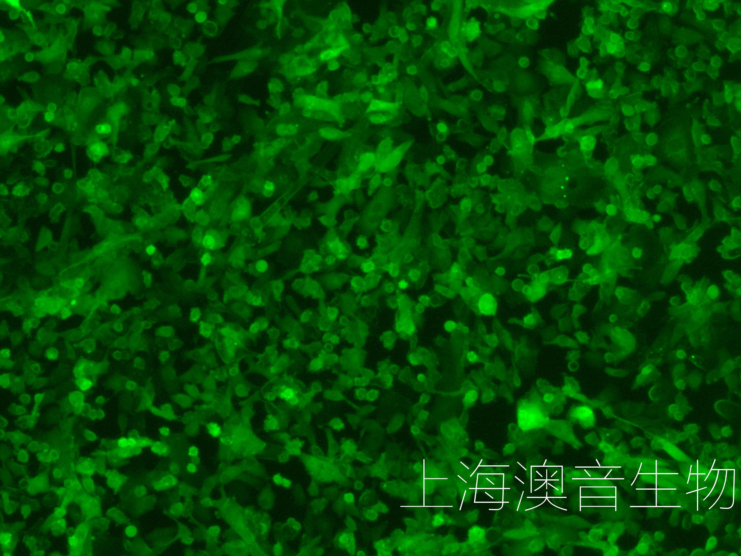 SK-HEP-1-LUC-GFP-240718-1