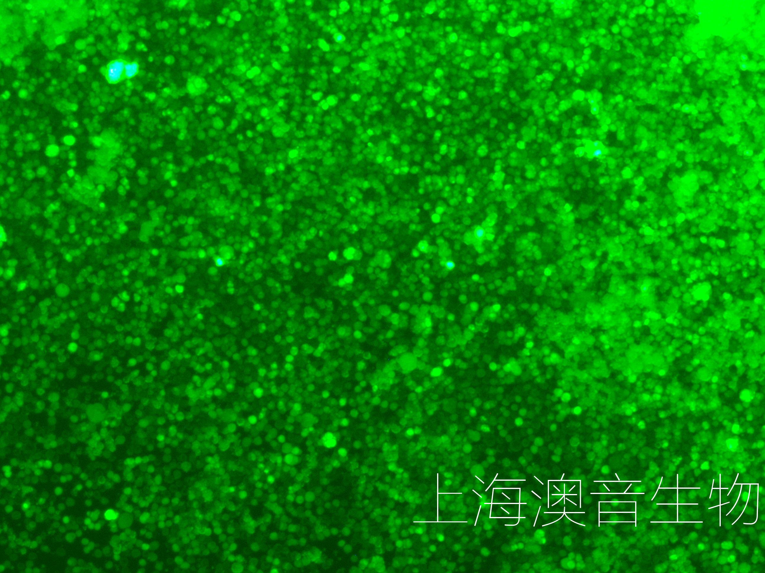 U266-LUC-GFP-240713-1